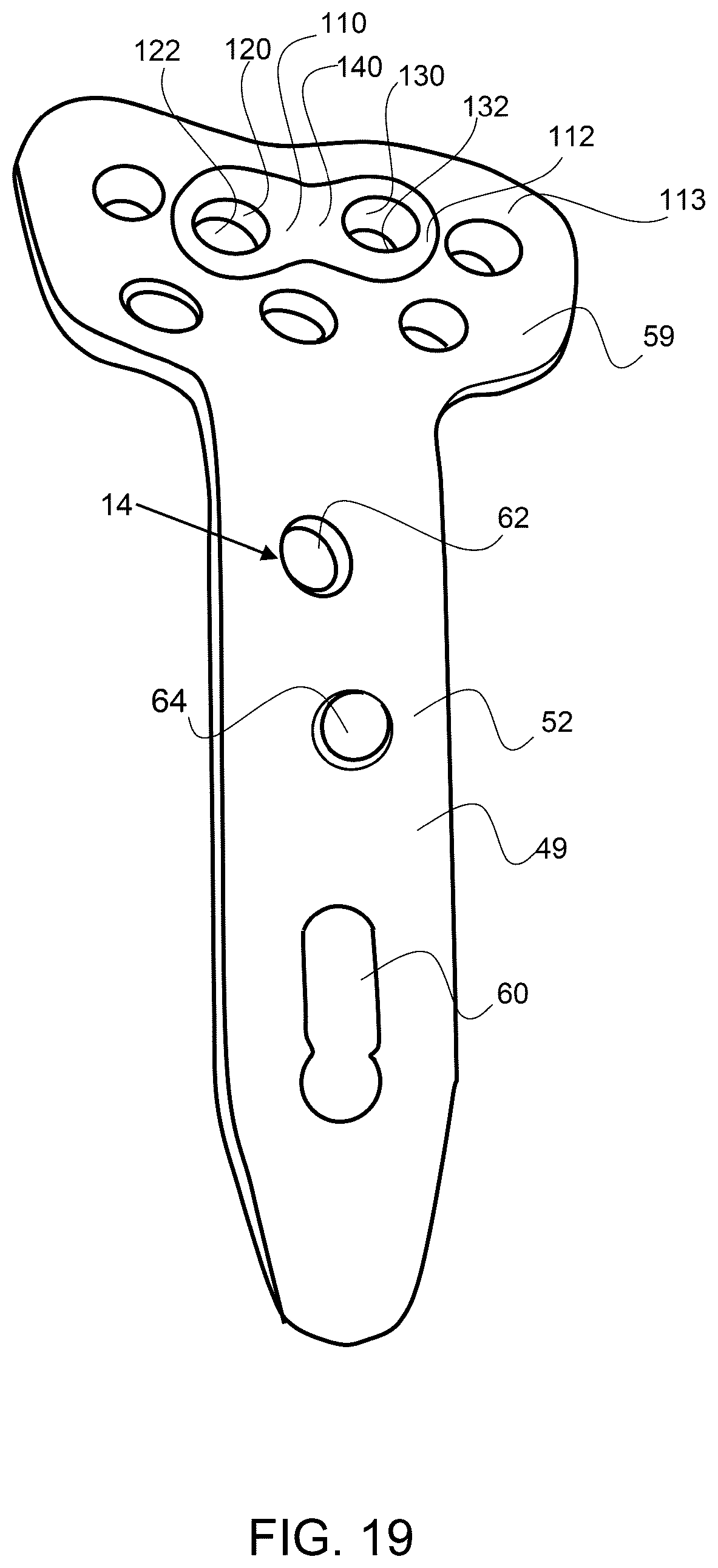 Patent US12611237 Figure 14 – Load sharing bone plate