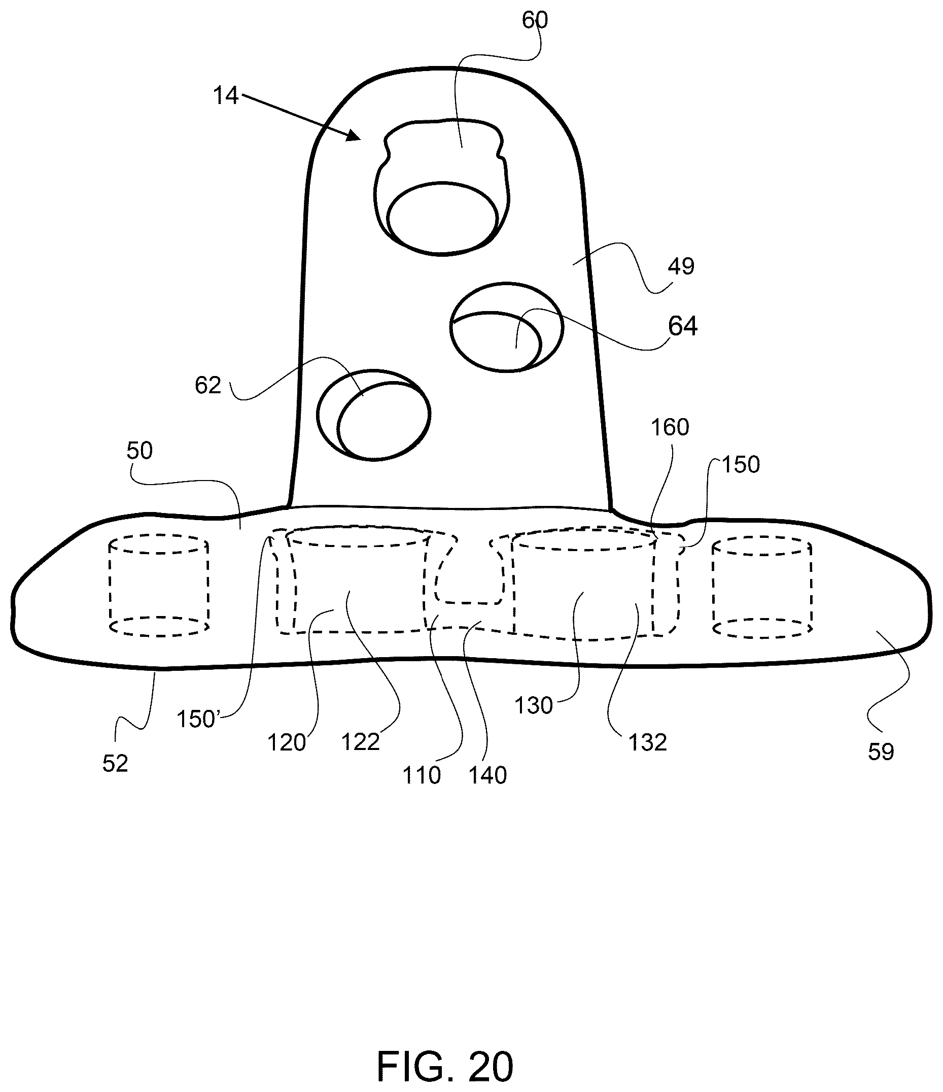 Patent US12611237 Figure 15 – Load sharing bone plate