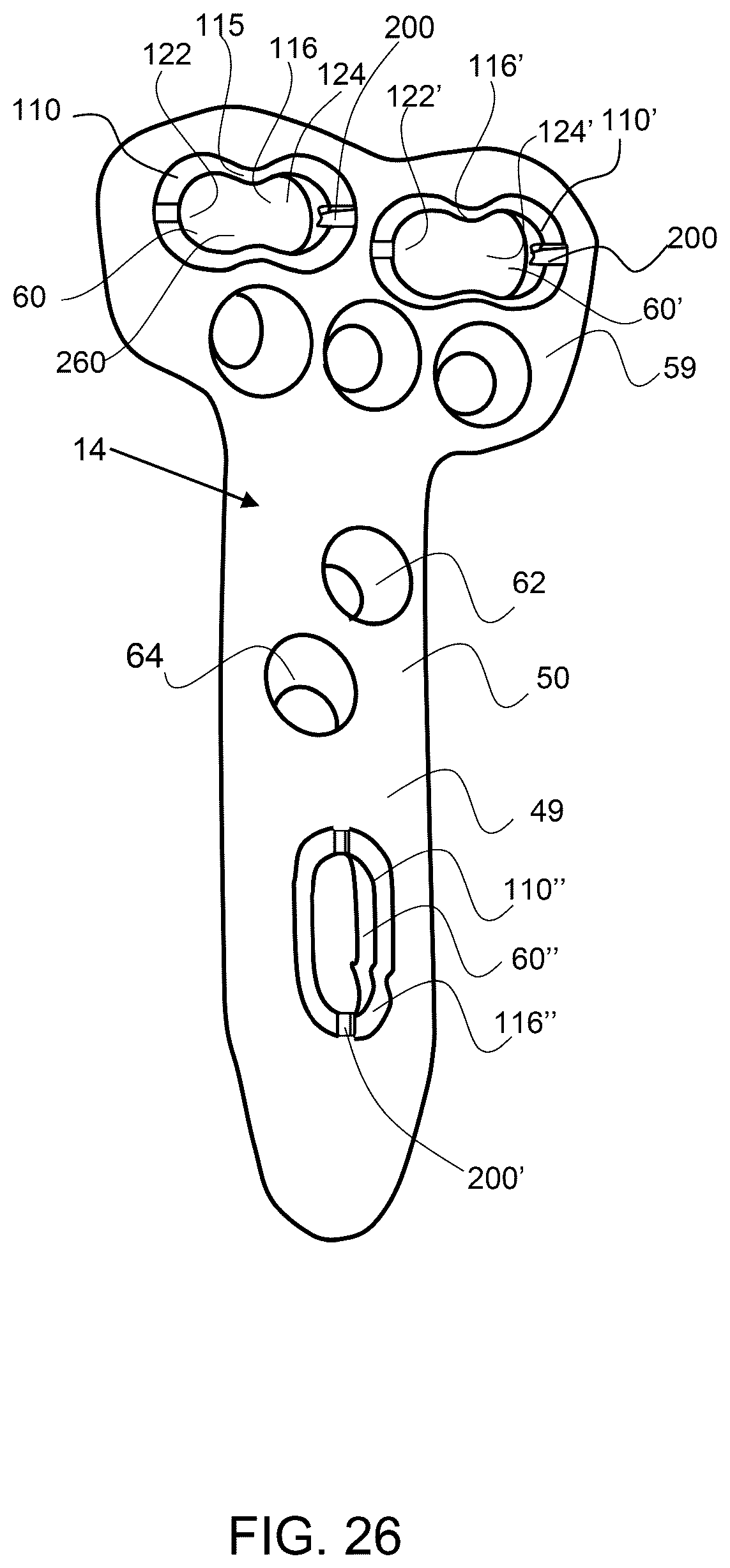 Patent US12611237 Figure 19 – Load sharing bone plate