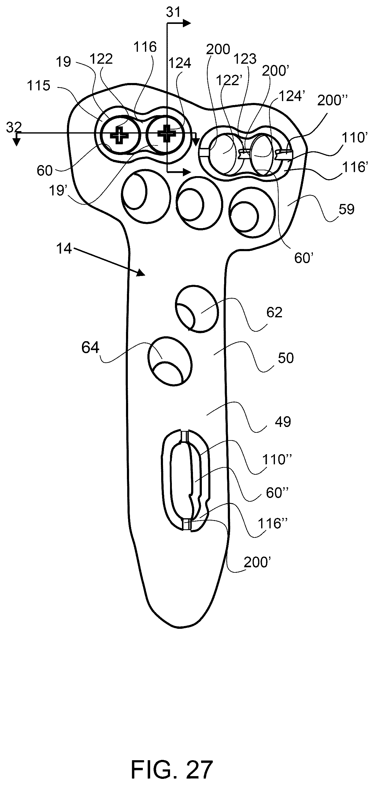 Patent US12611237 Figure 20 – Load sharing bone plate