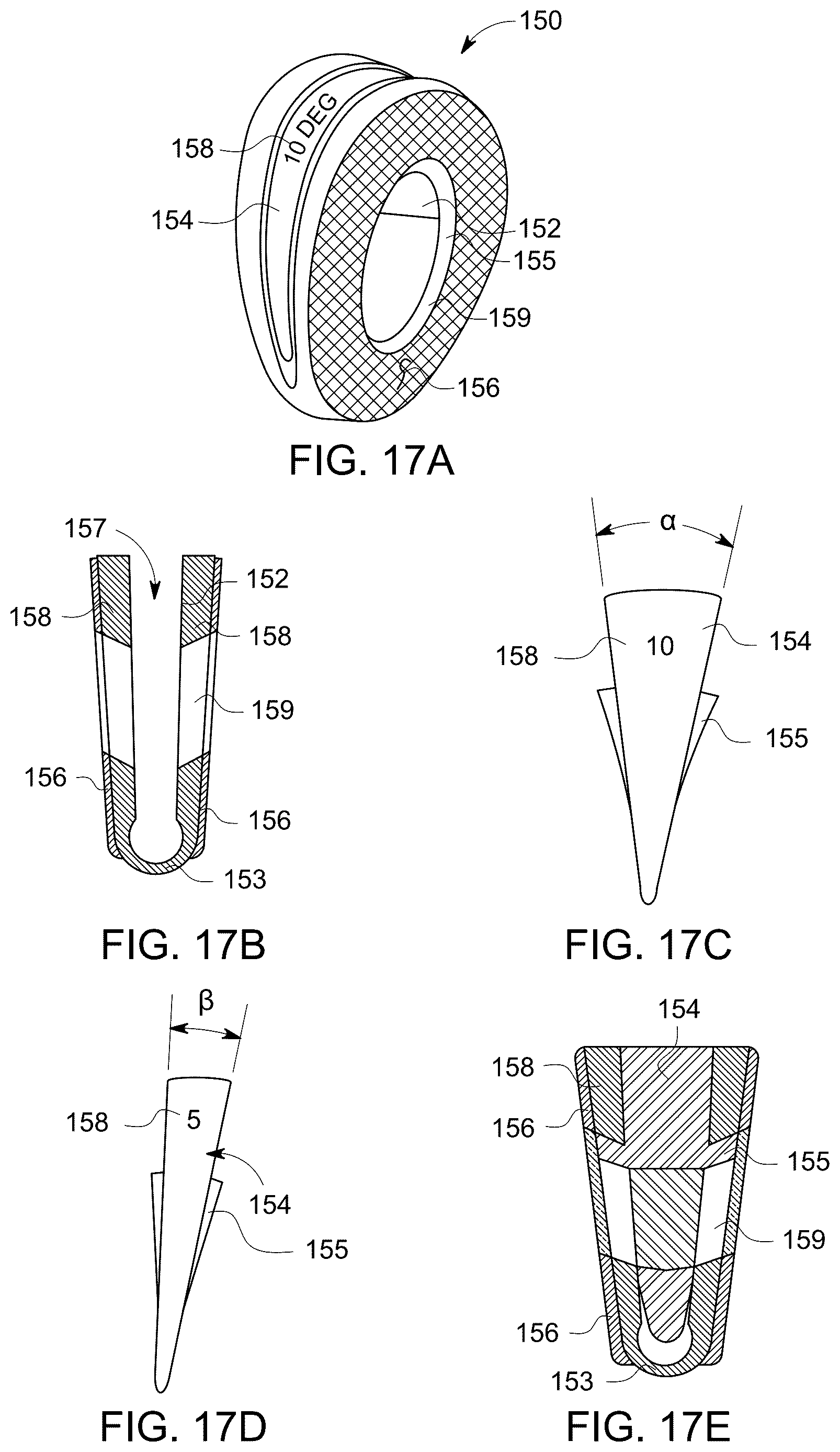 Patent US12611238 Figure 10 – Wedge osteotomy devices, systems, and methods for treating mid-foot disorders
