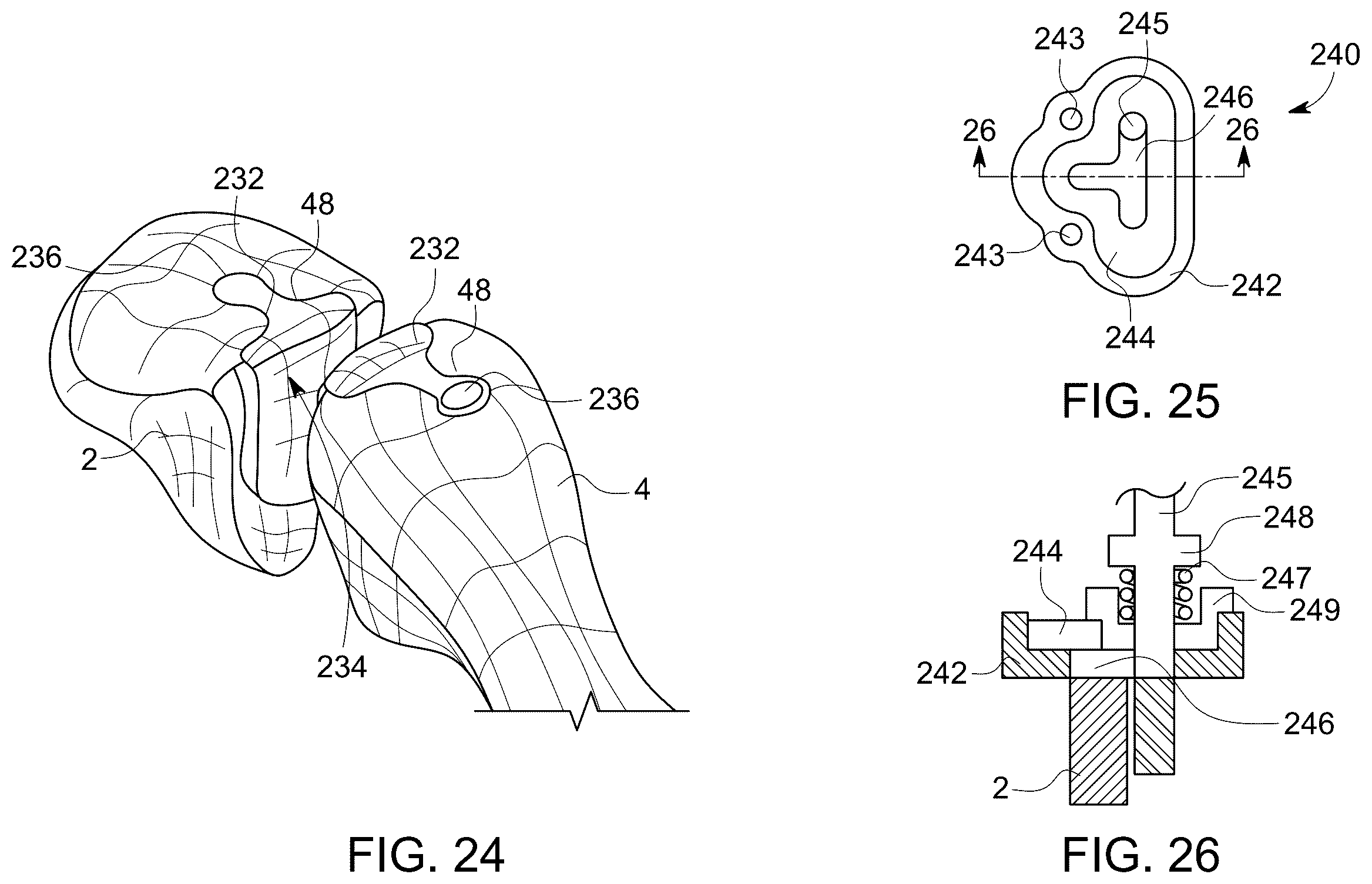Patent US12611238 Figure 15 – Wedge osteotomy devices, systems, and methods for treating mid-foot disorders