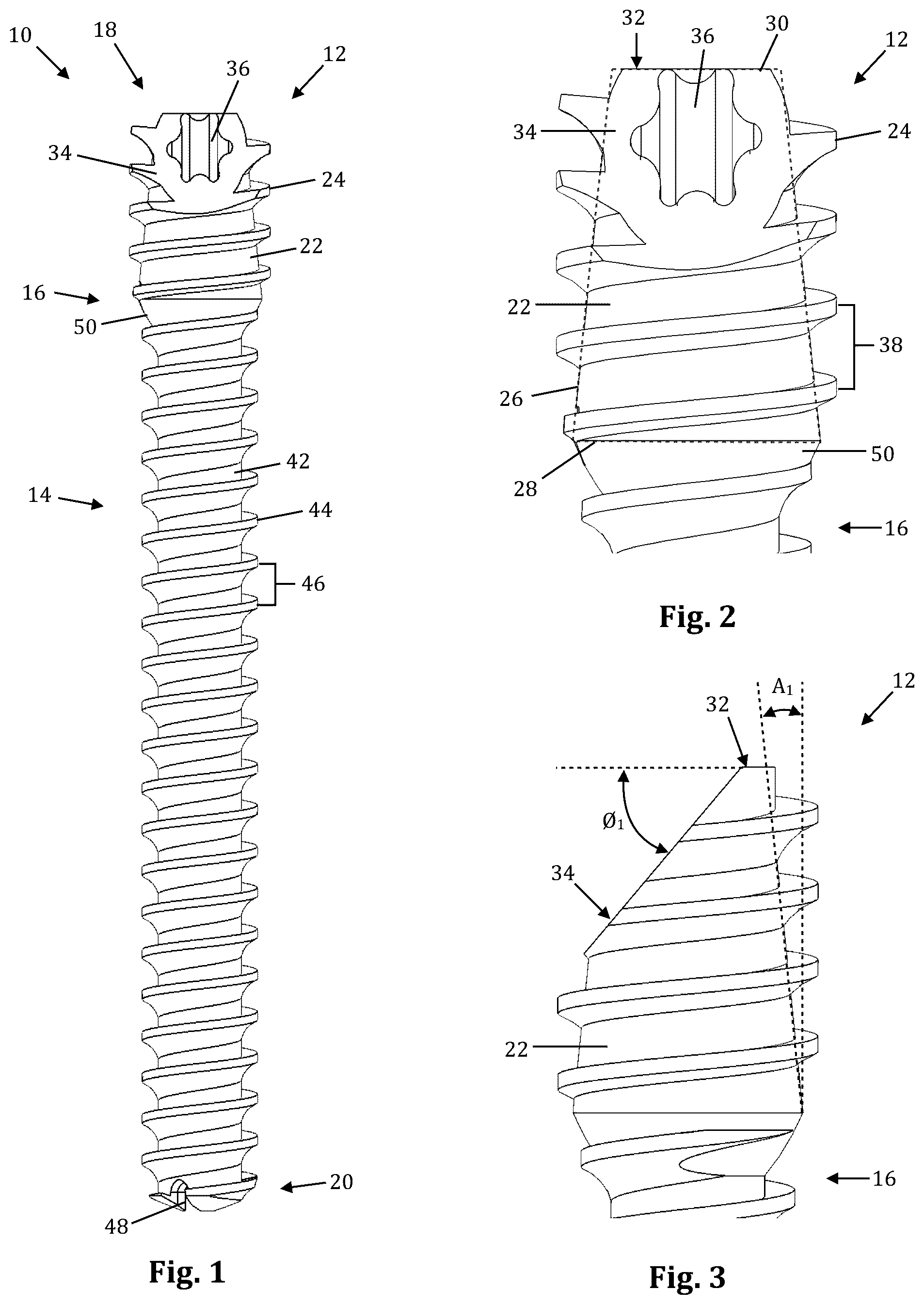 Patent US12611239 Figure 1 – Orthopedic bone screw