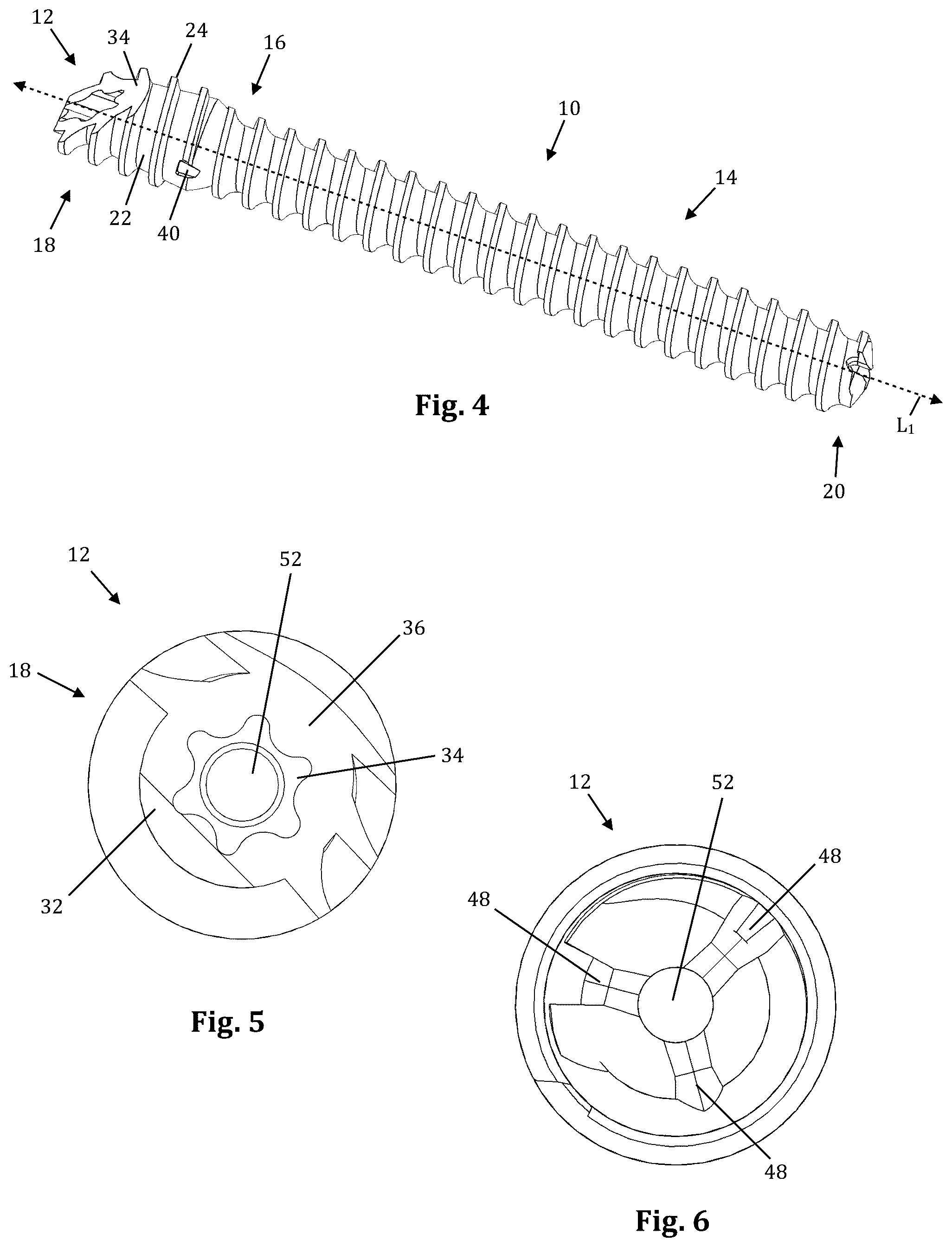 Patent US12611239 Figure 2 – Orthopedic bone screw