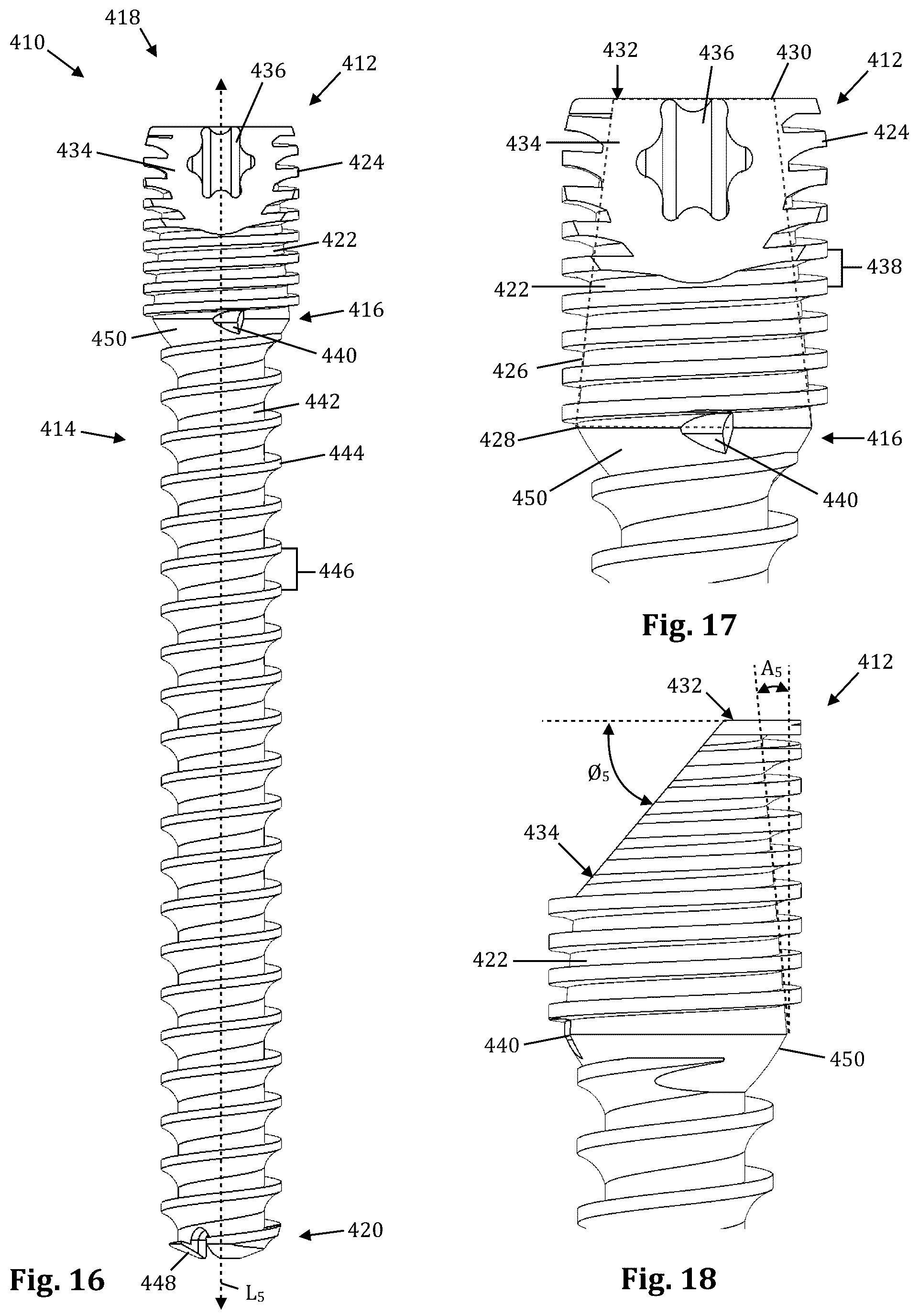 Patent US12611239 Figure 6 – Orthopedic bone screw