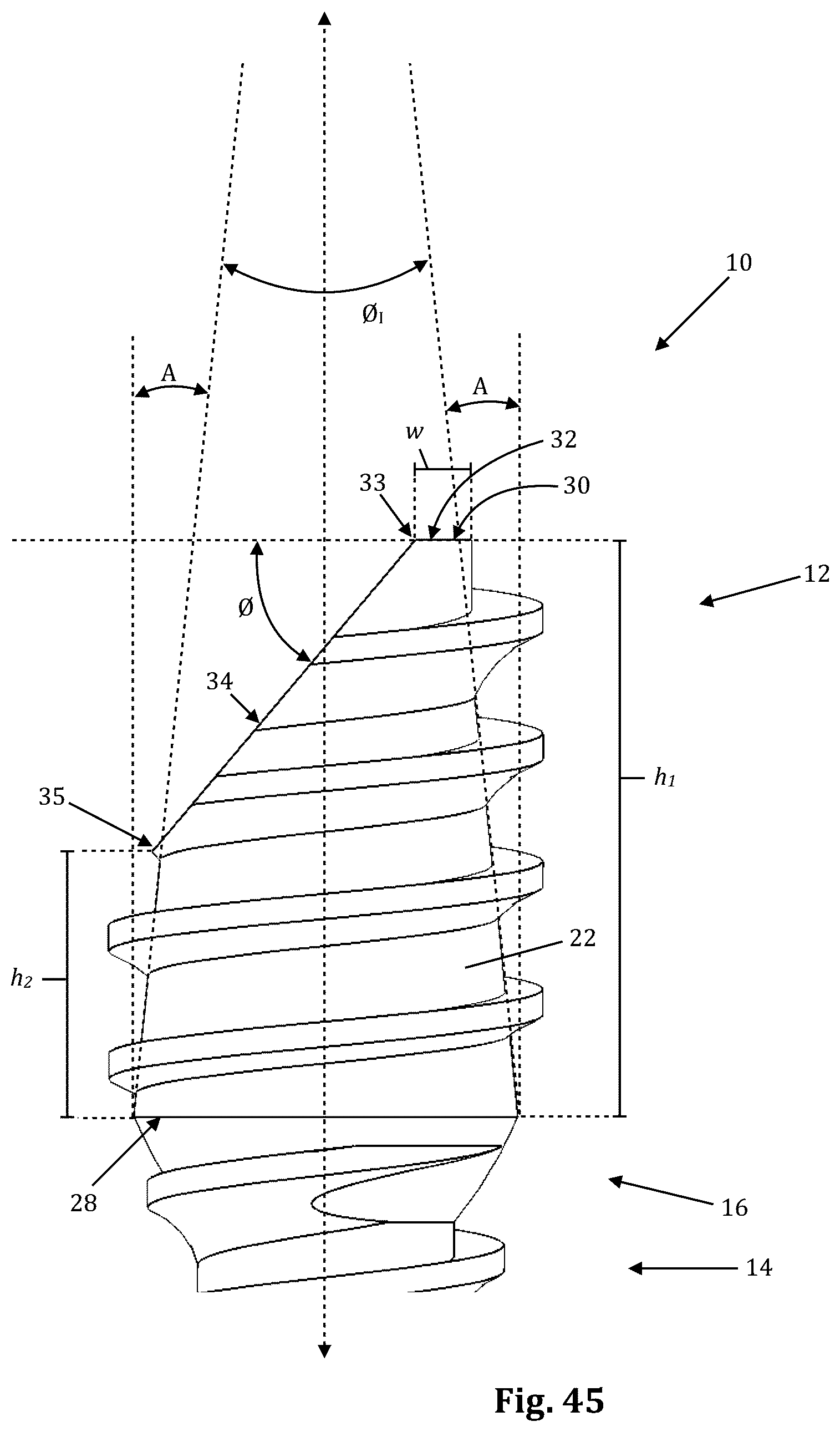 Patent US12611239 Figure 18 – Orthopedic bone screw