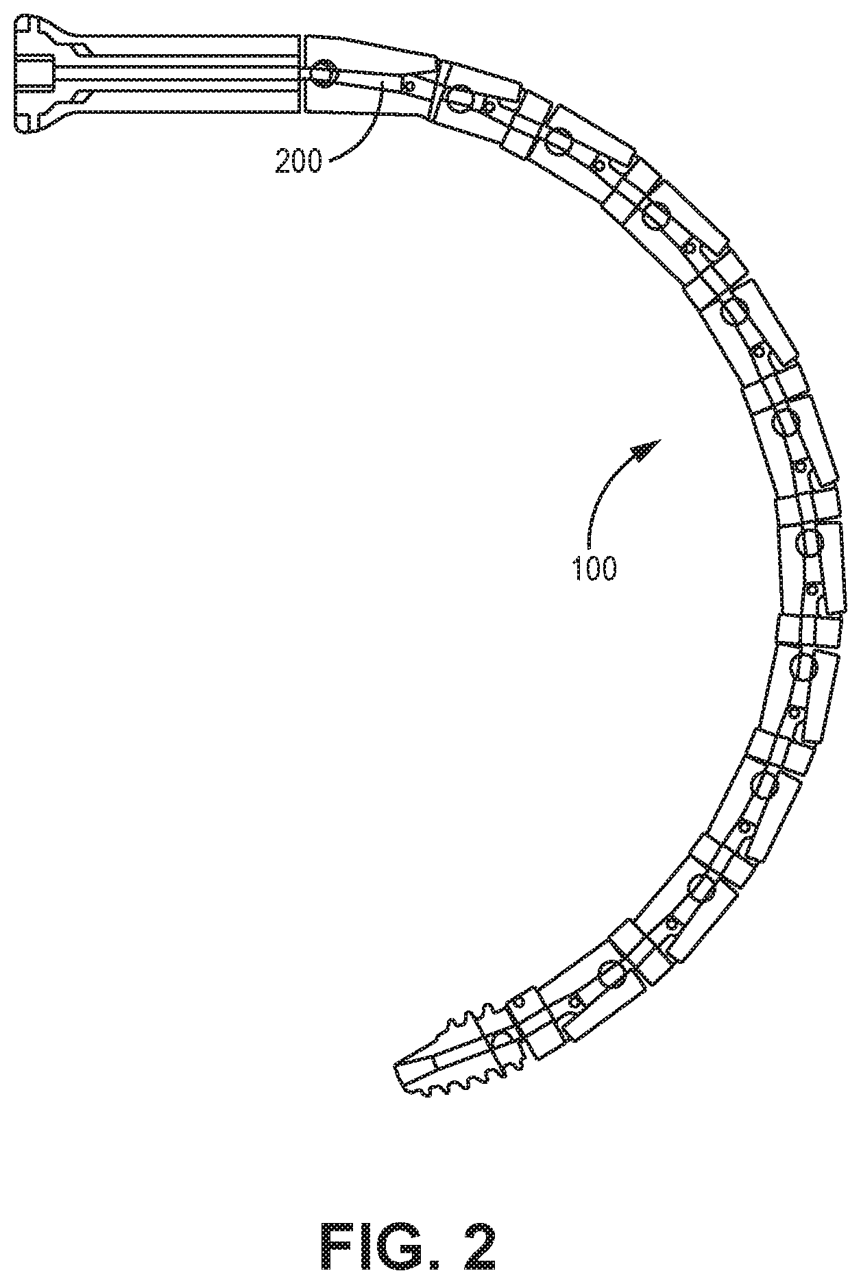 Patent US12611240 Figure 2 – Intramedullary fixation device