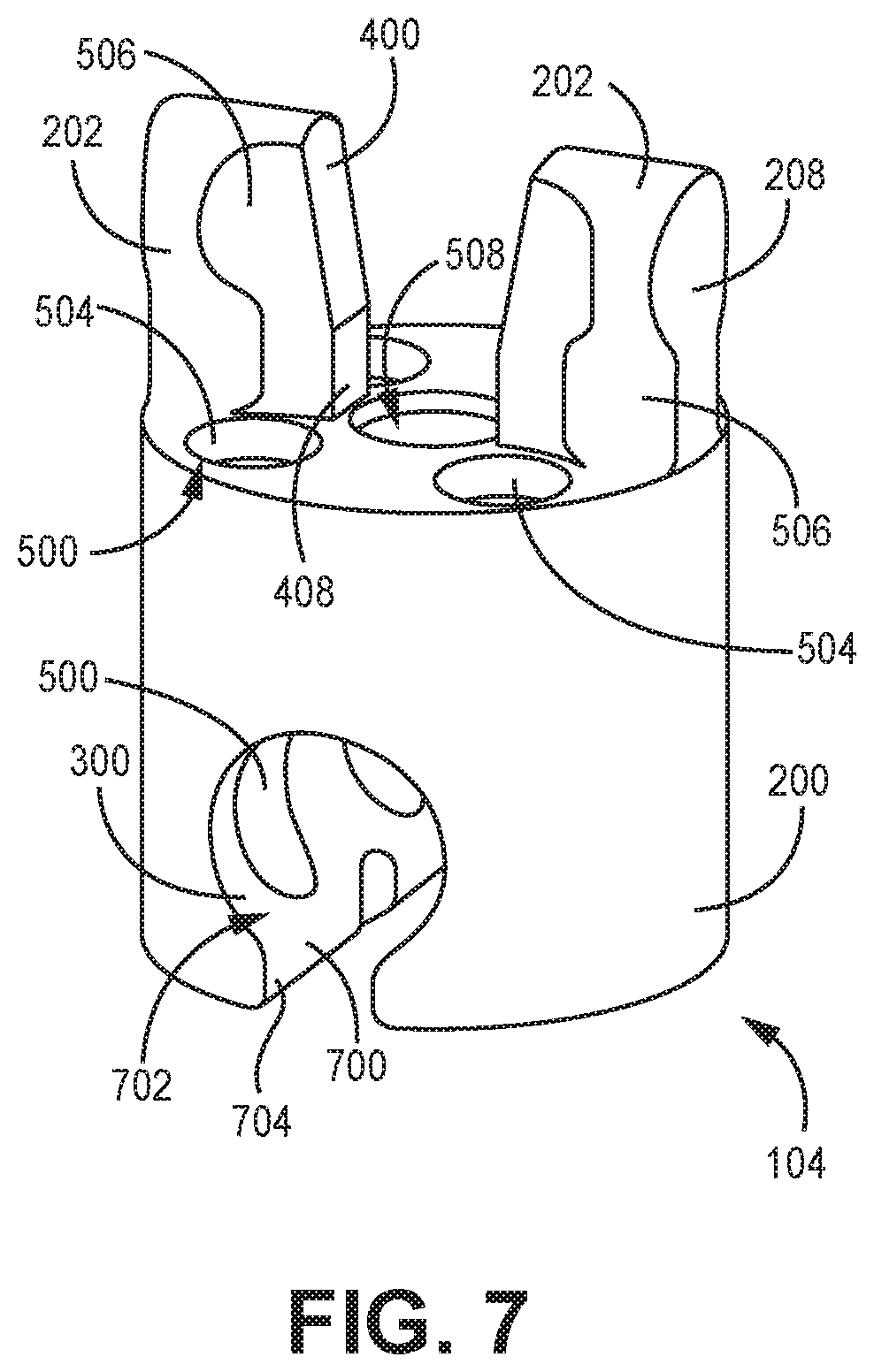 Patent US12611240 Figure 7 – Intramedullary fixation device