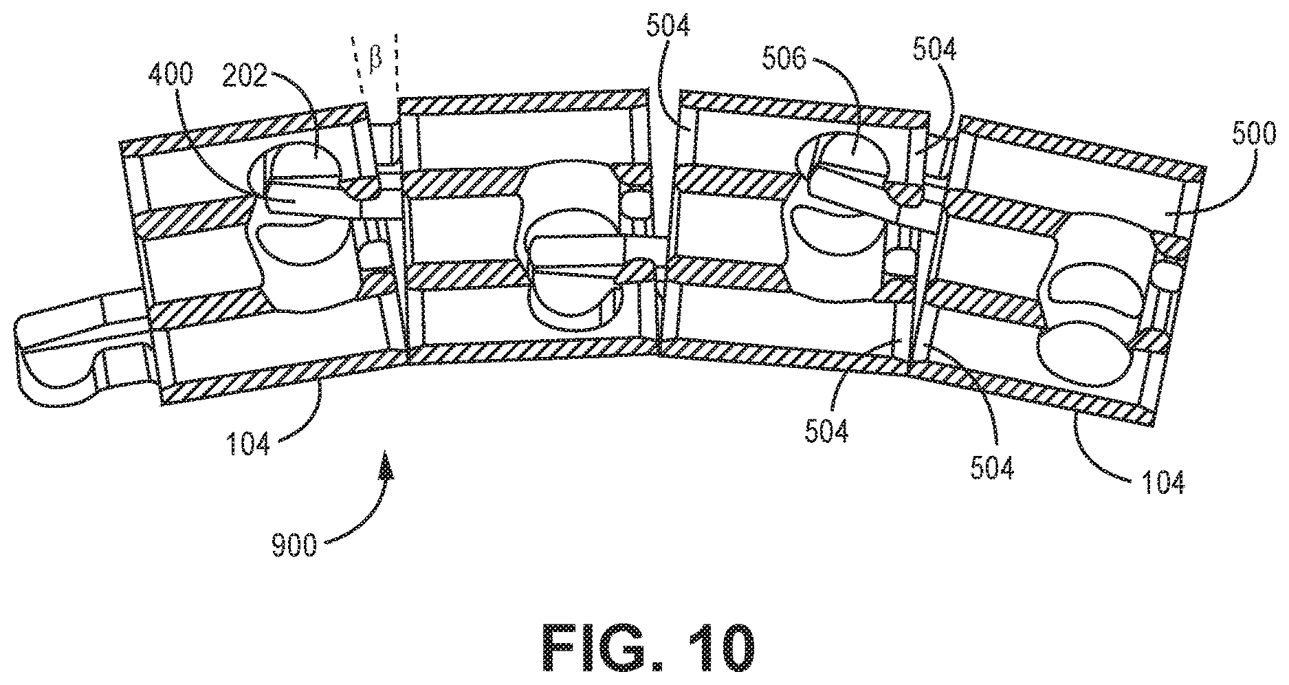 Patent US12611240 Figure 10 – Intramedullary fixation device
