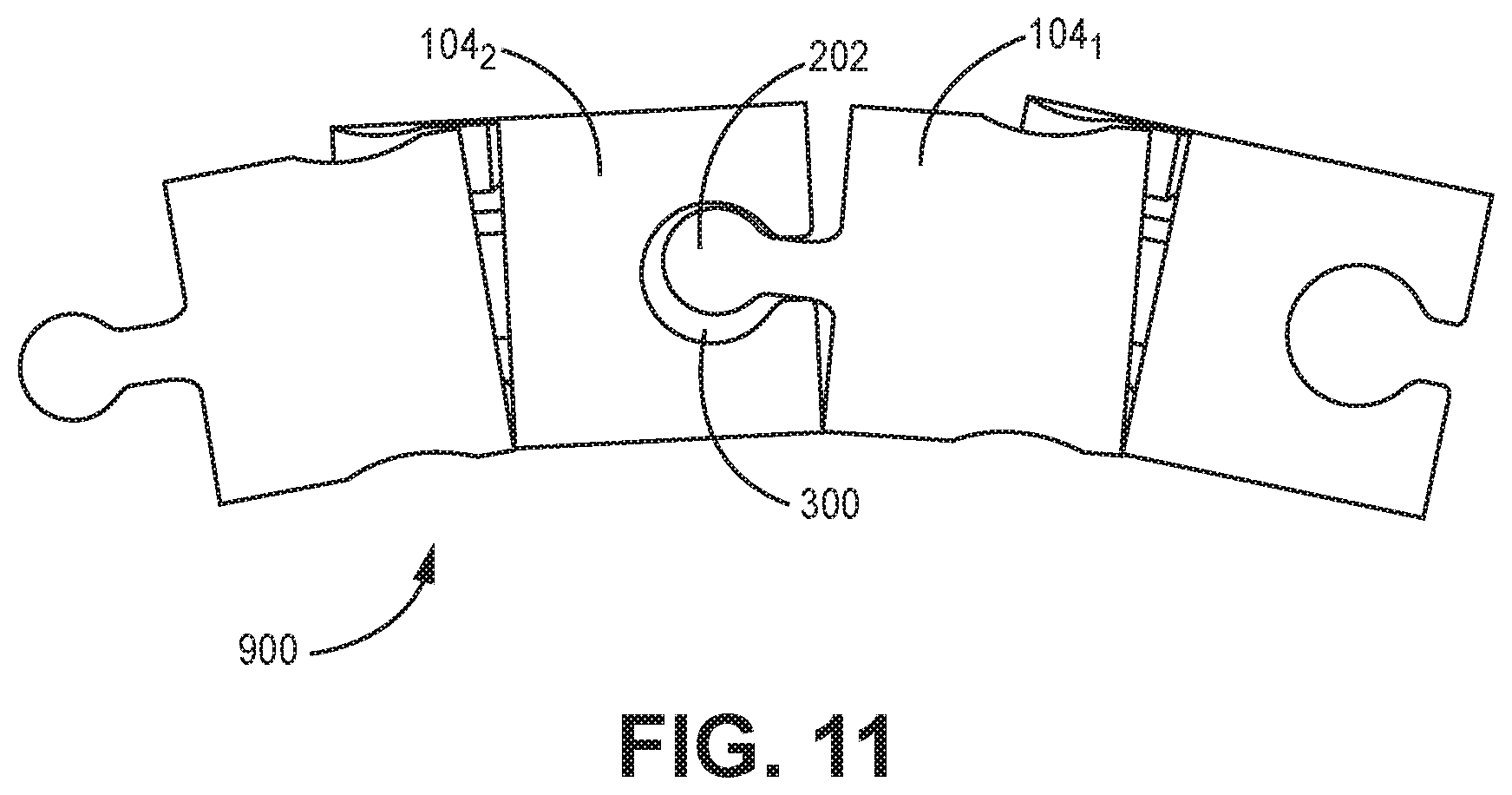 Patent US12611240 Figure 11 – Intramedullary fixation device
