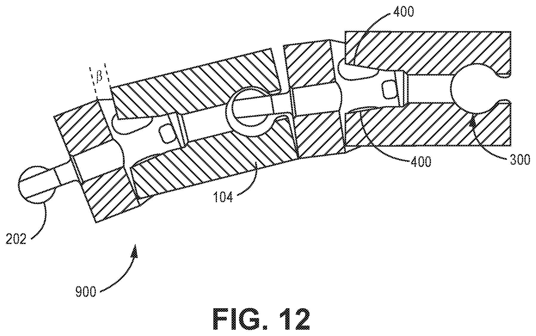 Patent US12611240 Figure 12 – Intramedullary fixation device