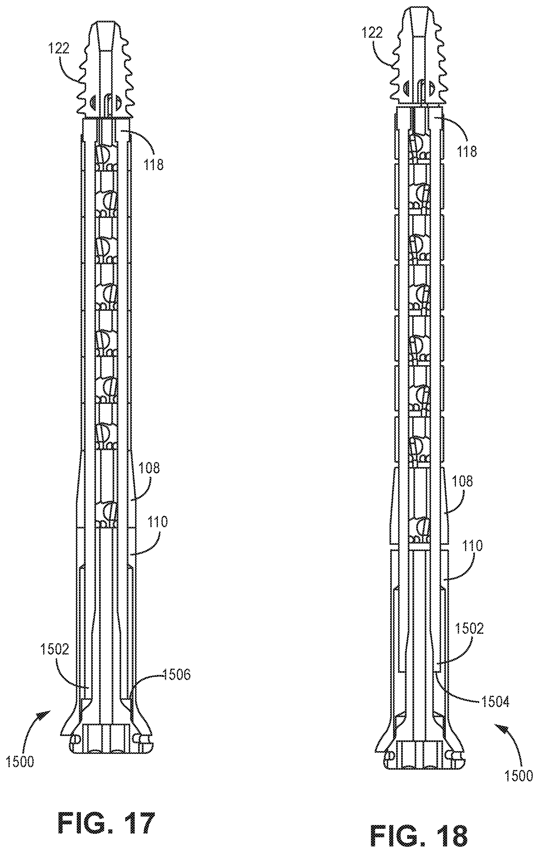 Patent US12611240 Figure 15 – Intramedullary fixation device
