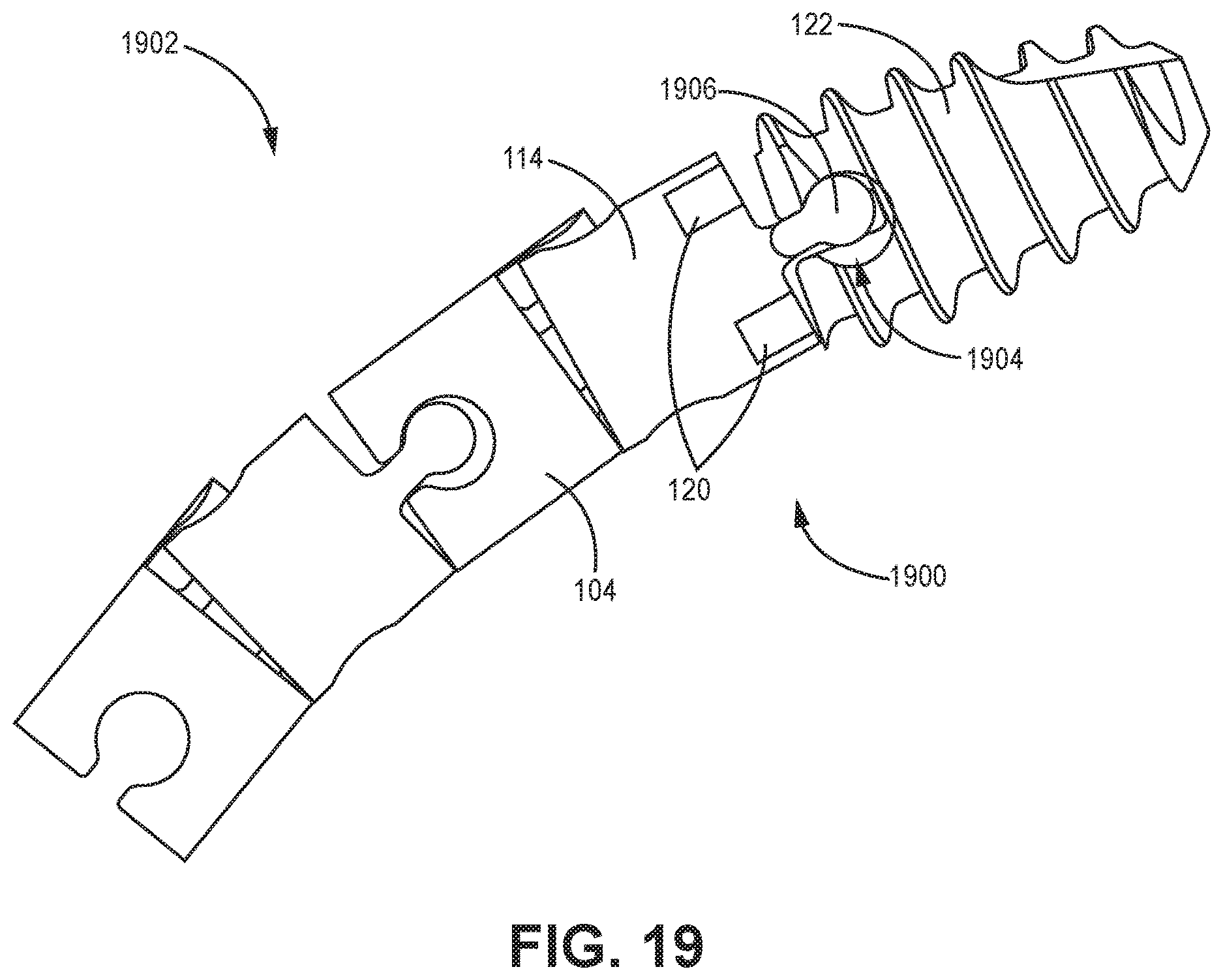 Patent US12611240 Figure 16 – Intramedullary fixation device