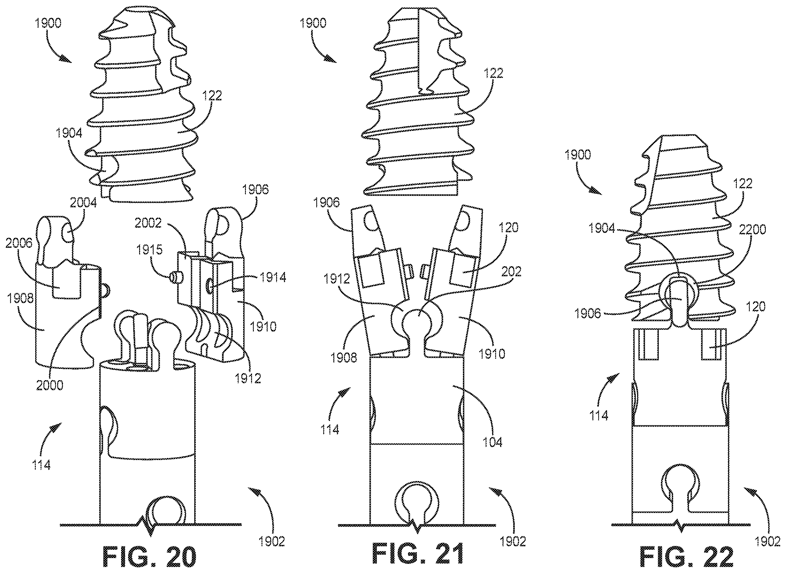 Patent US12611240 Figure 17 – Intramedullary fixation device