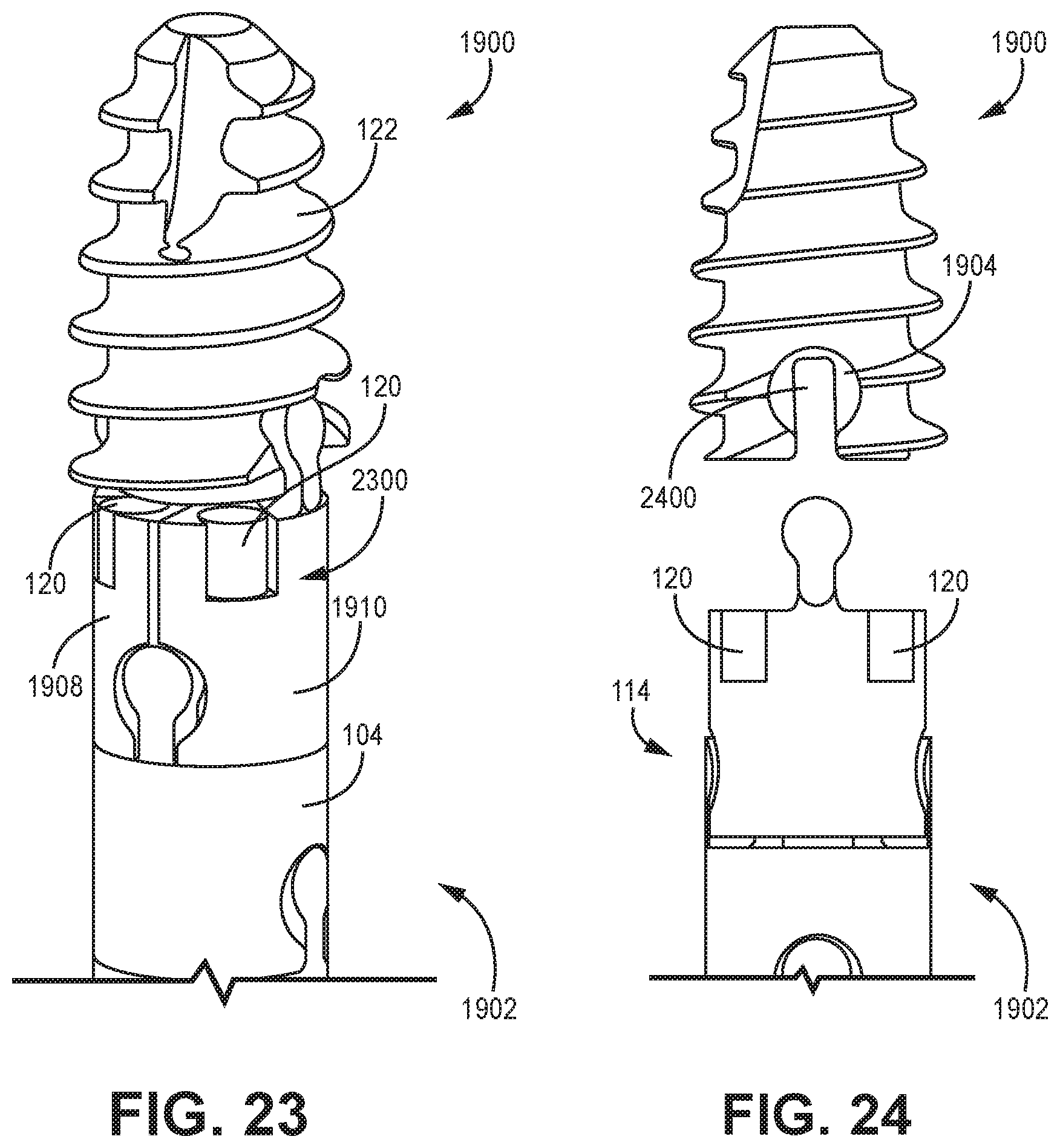 Patent US12611240 Figure 18 – Intramedullary fixation device