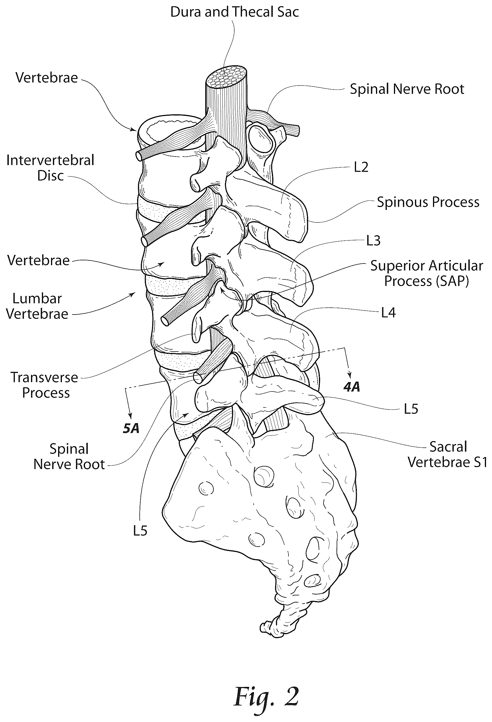 Patent US12611241 Figure 2 – Methods, systems, and devices for the treatment of stenosis