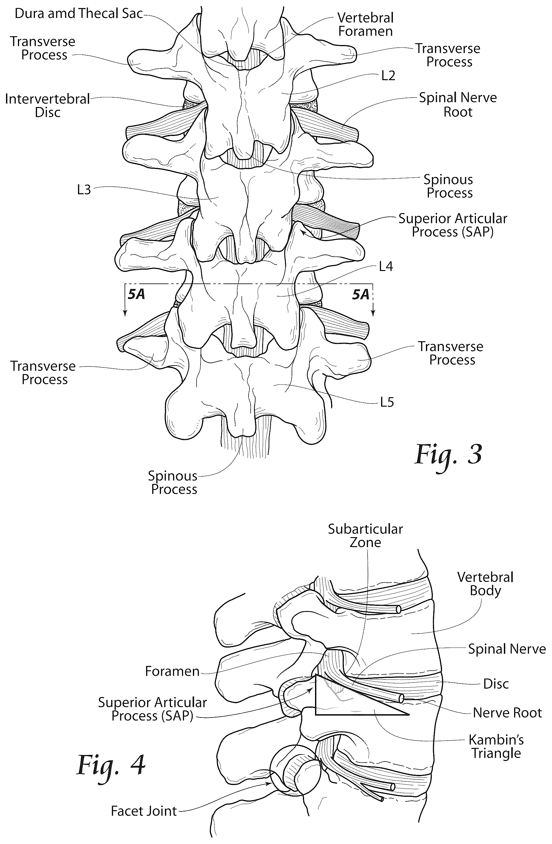 Patent US12611241 Figure 3 – Methods, systems, and devices for the treatment of stenosis