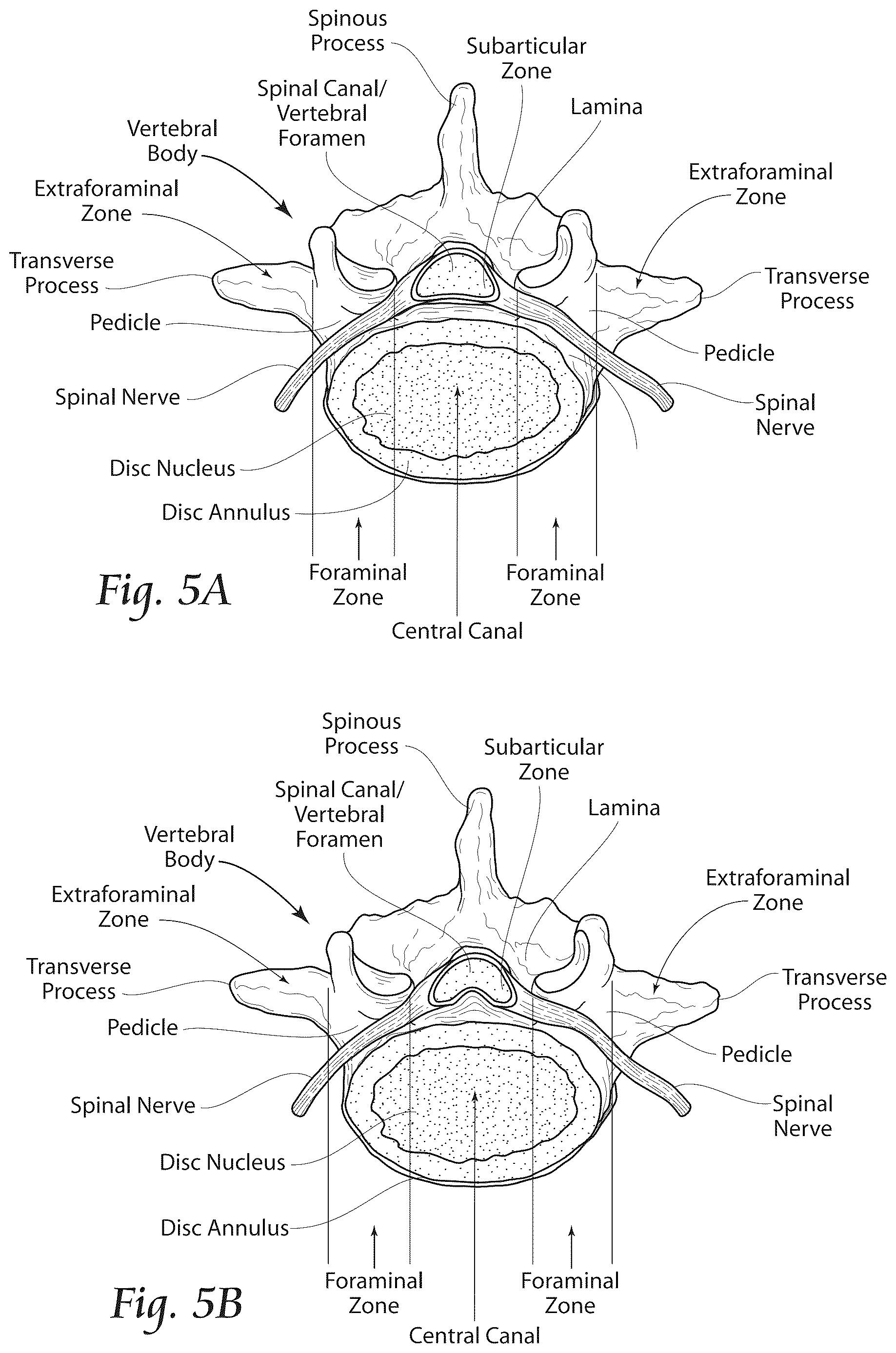 Patent US12611241 Figure 4 – Methods, systems, and devices for the treatment of stenosis