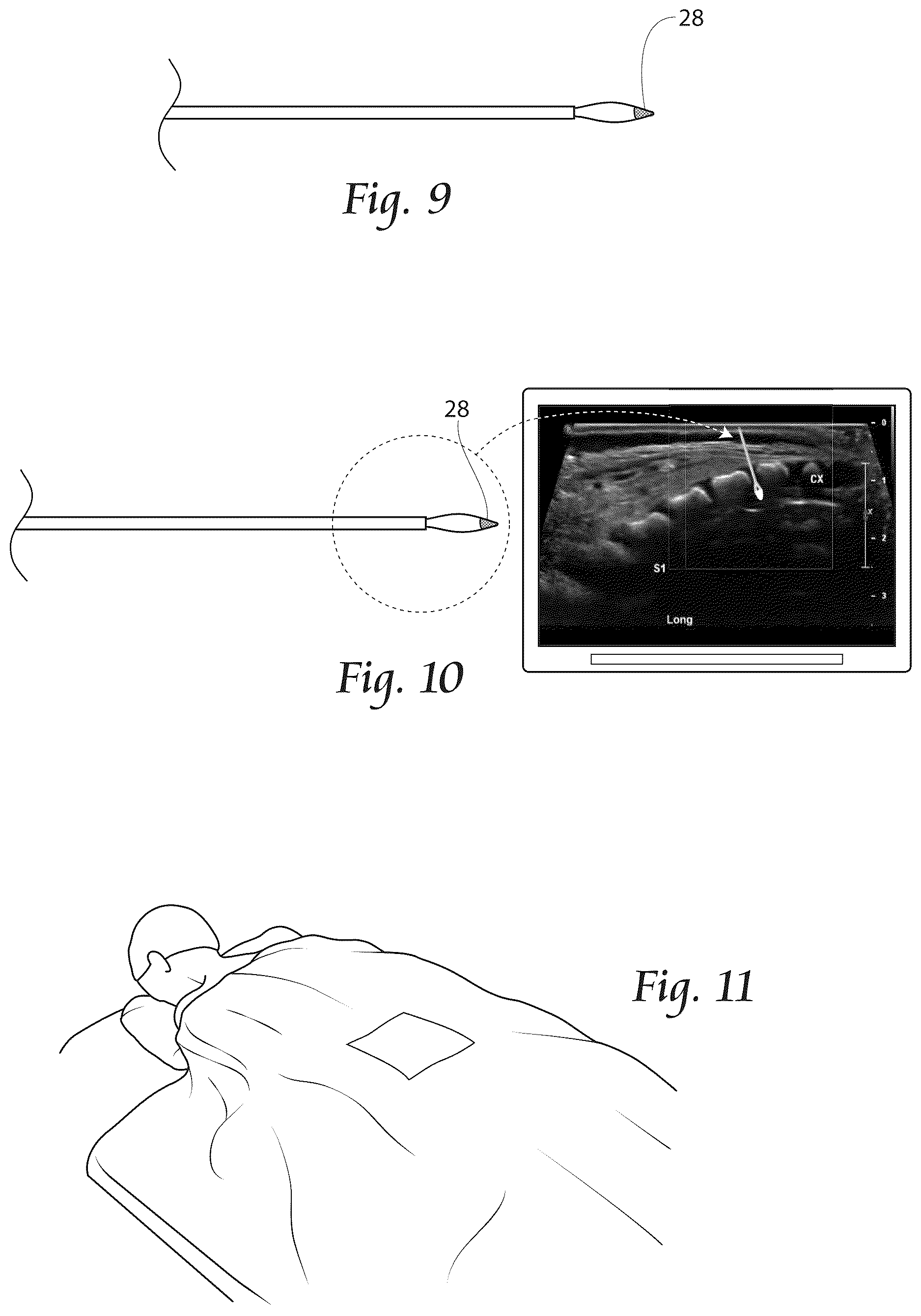 Patent US12611241 Figure 6 – Methods, systems, and devices for the treatment of stenosis