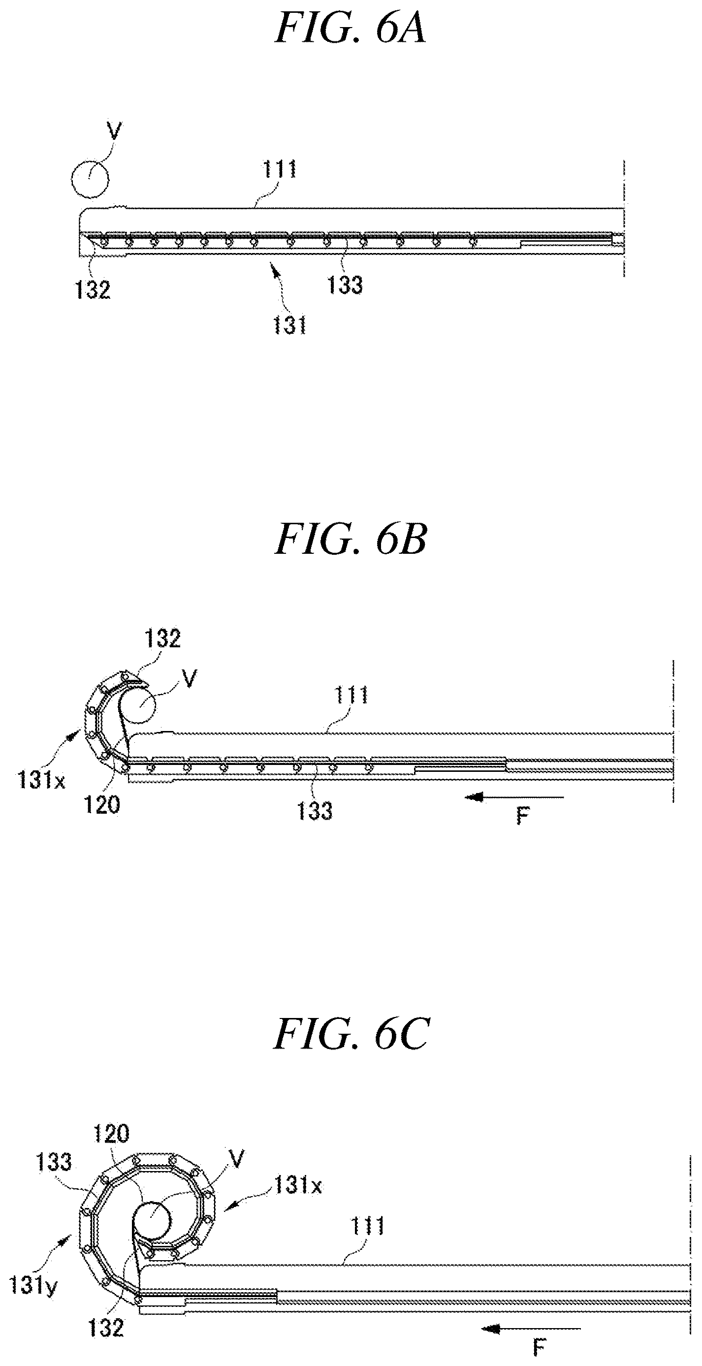 Patent US12611245 Figure 4 – Electrode device for blocking or controlling nerves in body