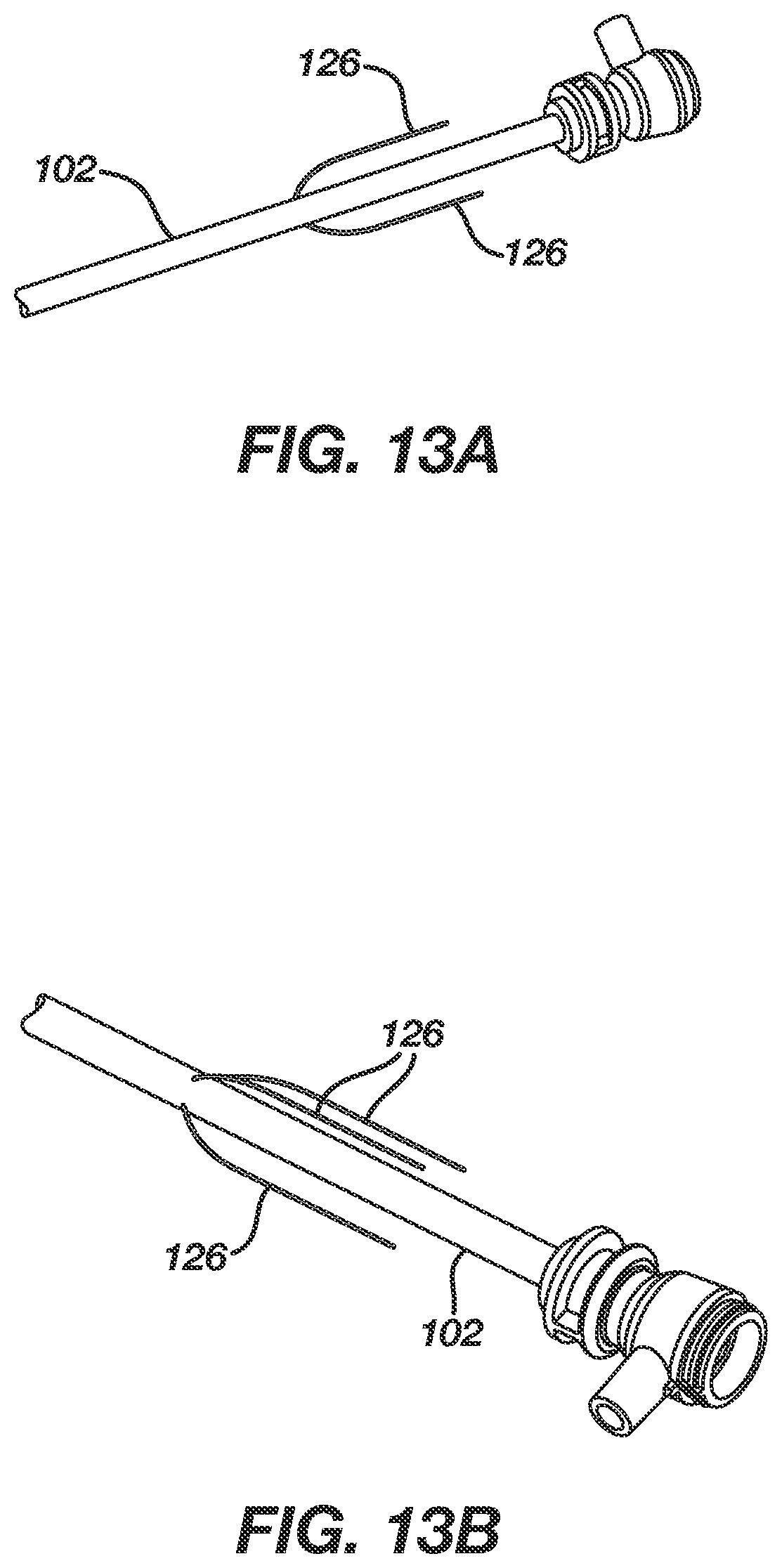 Patent US12611247 Figure 15 – Steerable sheath and catheter with circular deflection