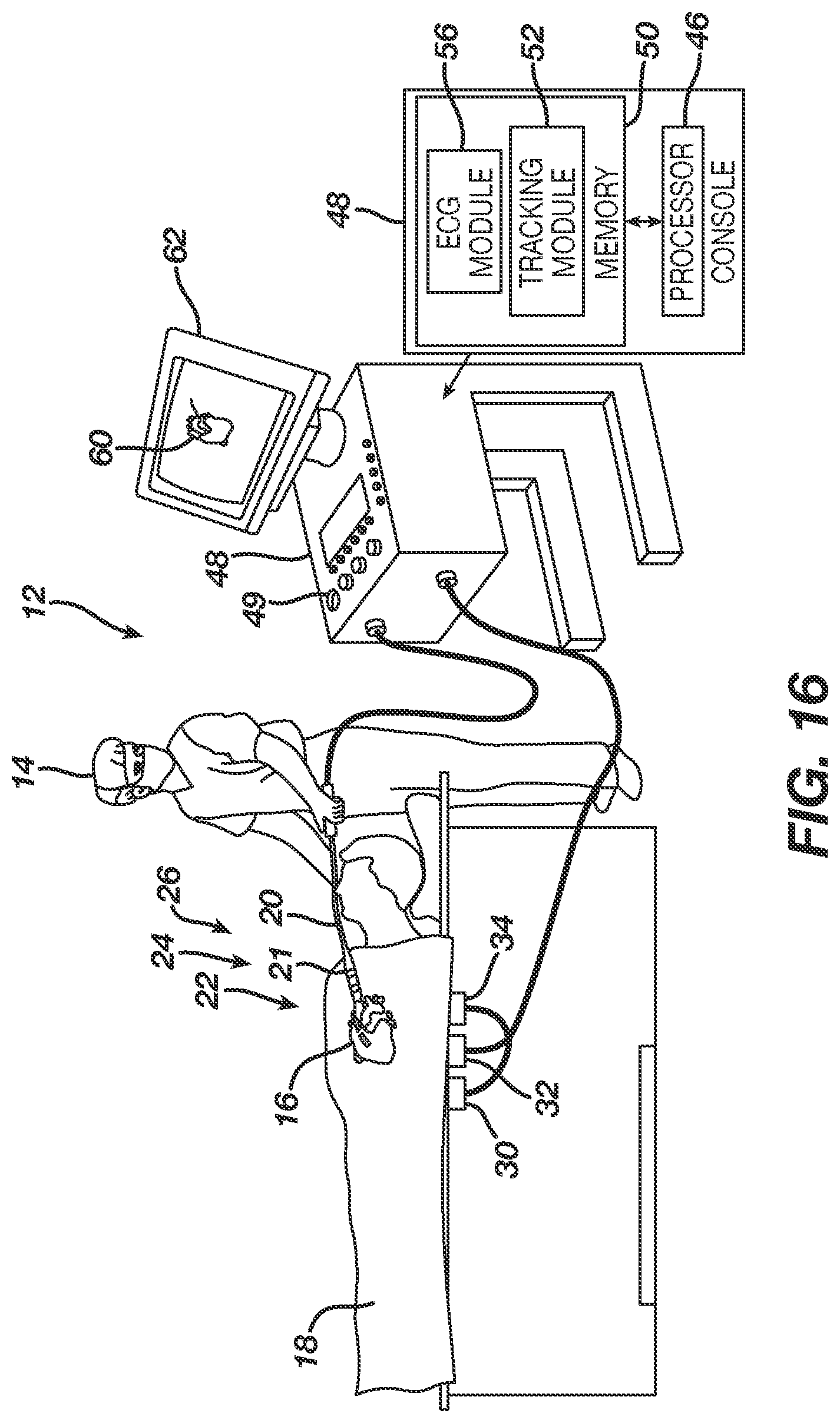 Patent US12611247 Figure 18 – Steerable sheath and catheter with circular deflection