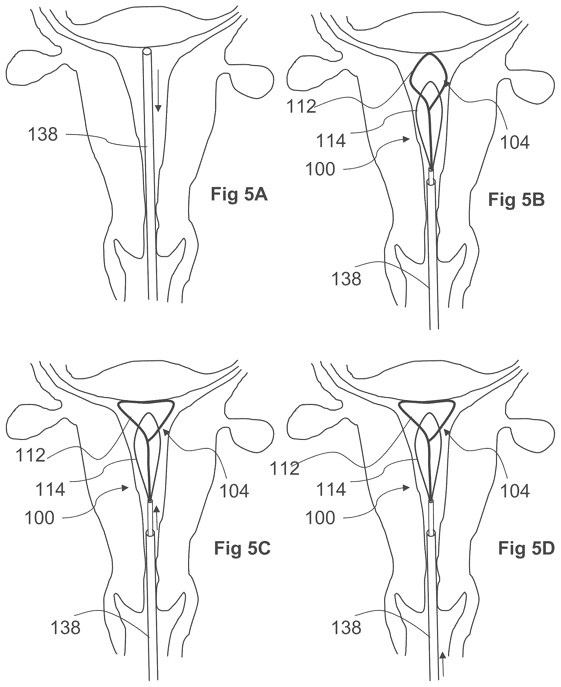 Patent US12611249 Figure 10 – Methods and devices for applying energy to bodily tissues