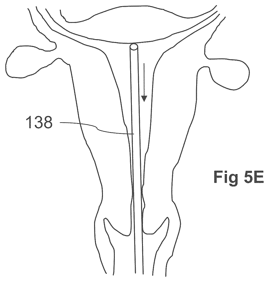 Patent US12611249 Figure 11 – Methods and devices for applying energy to bodily tissues