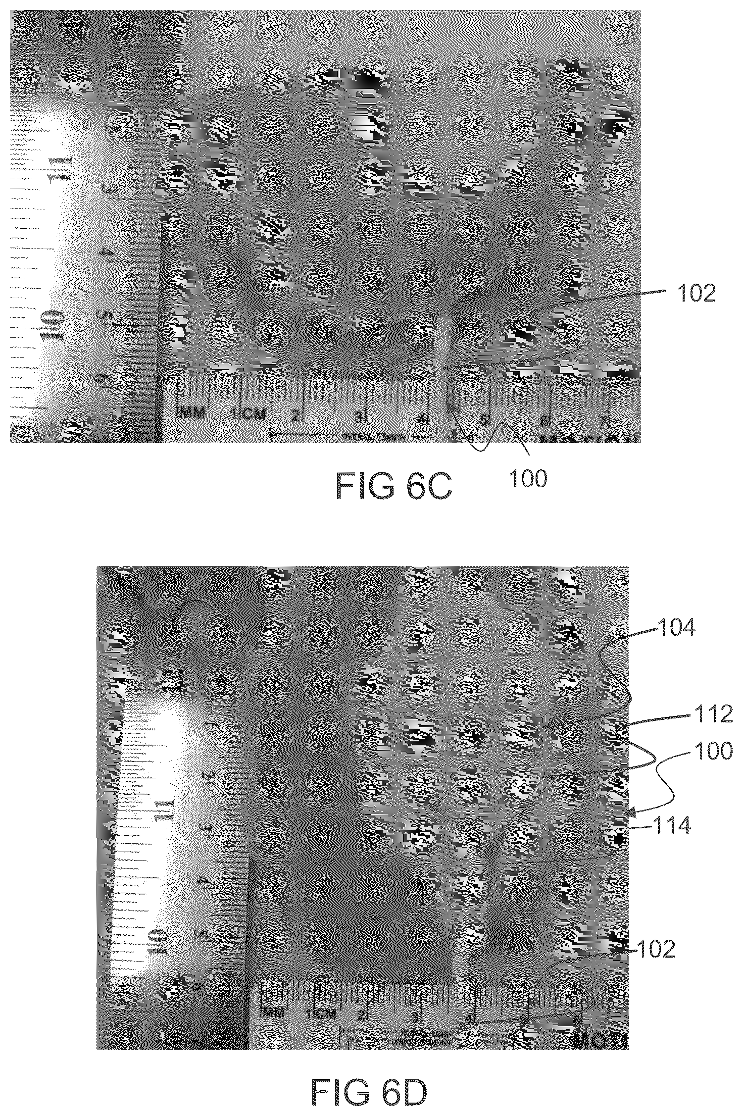 Patent US12611249 Figure 13 – Methods and devices for applying energy to bodily tissues