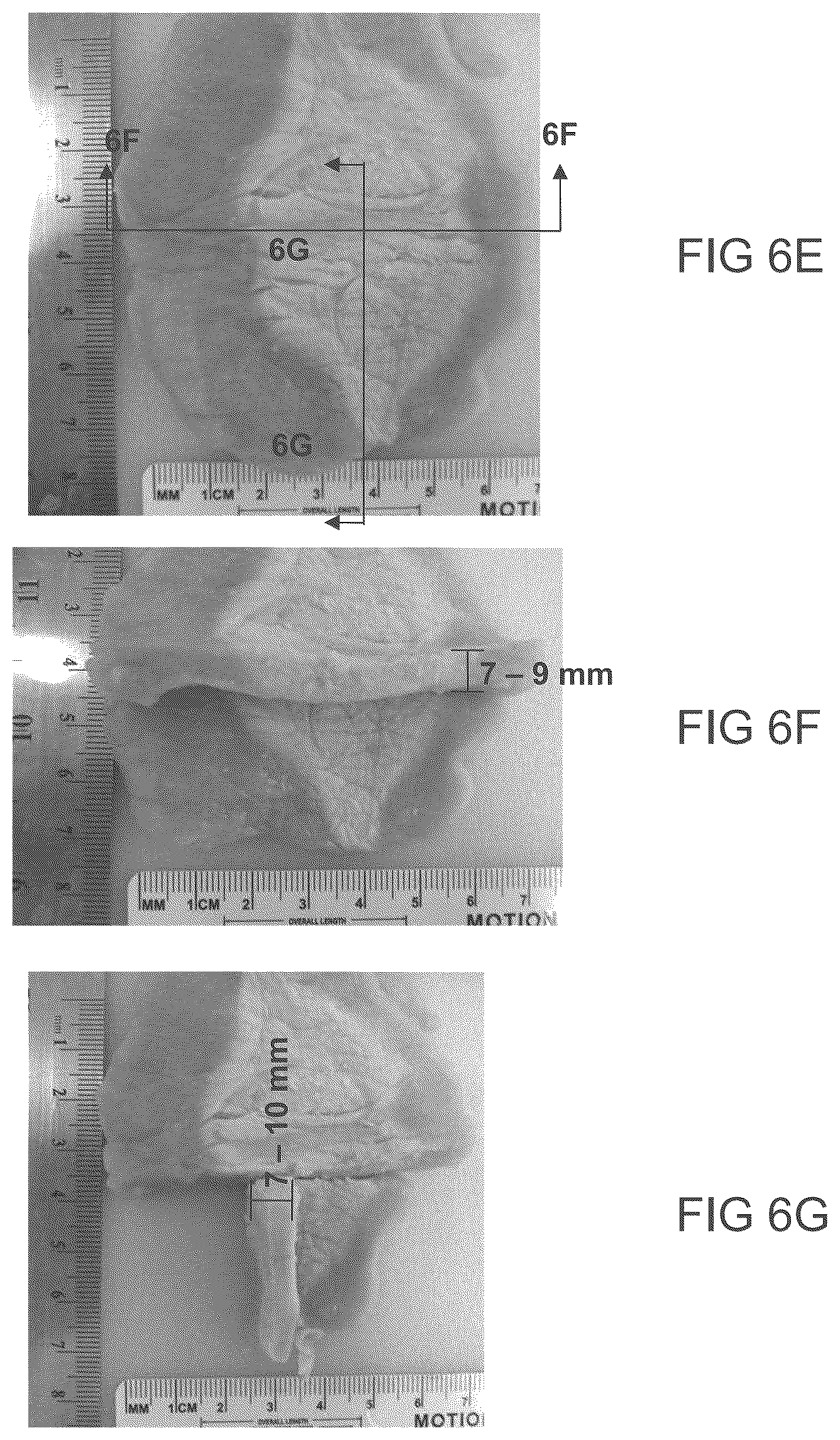 Patent US12611249 Figure 14 – Methods and devices for applying energy to bodily tissues