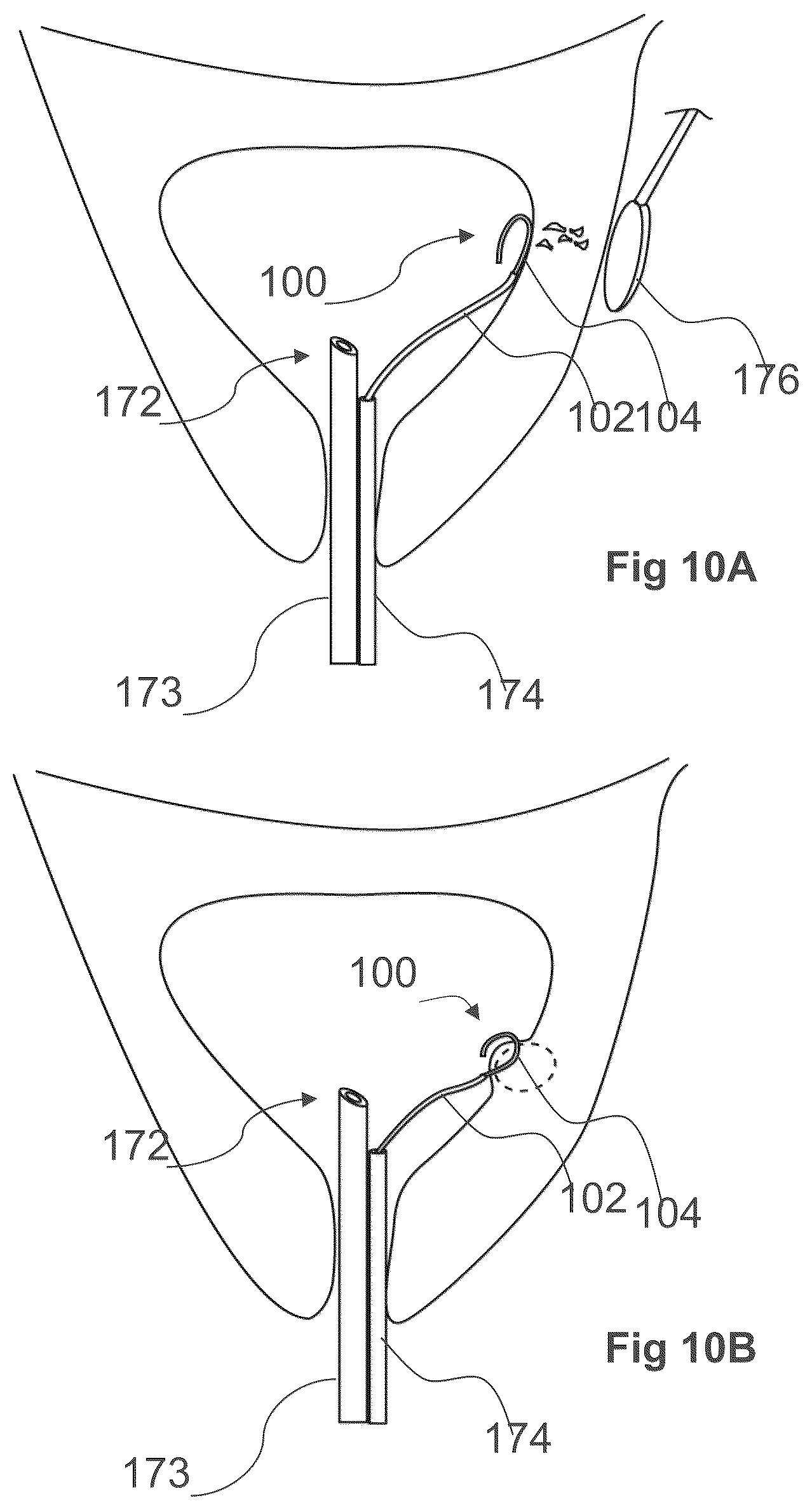 Patent US12611249 Figure 18 – Methods and devices for applying energy to bodily tissues
