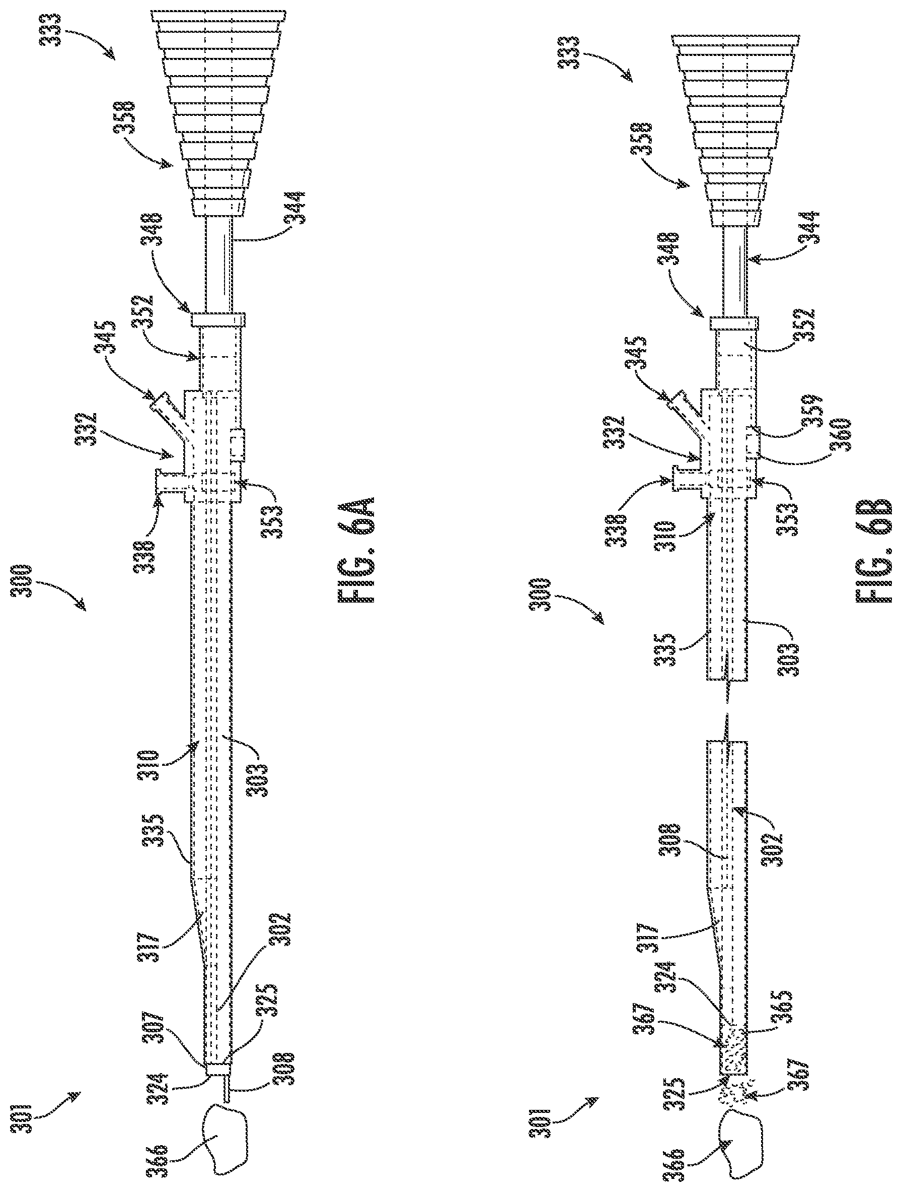 Patent US12611251 Figure 7 – Devices, assemblies, and methods for removal of a bodily mass
