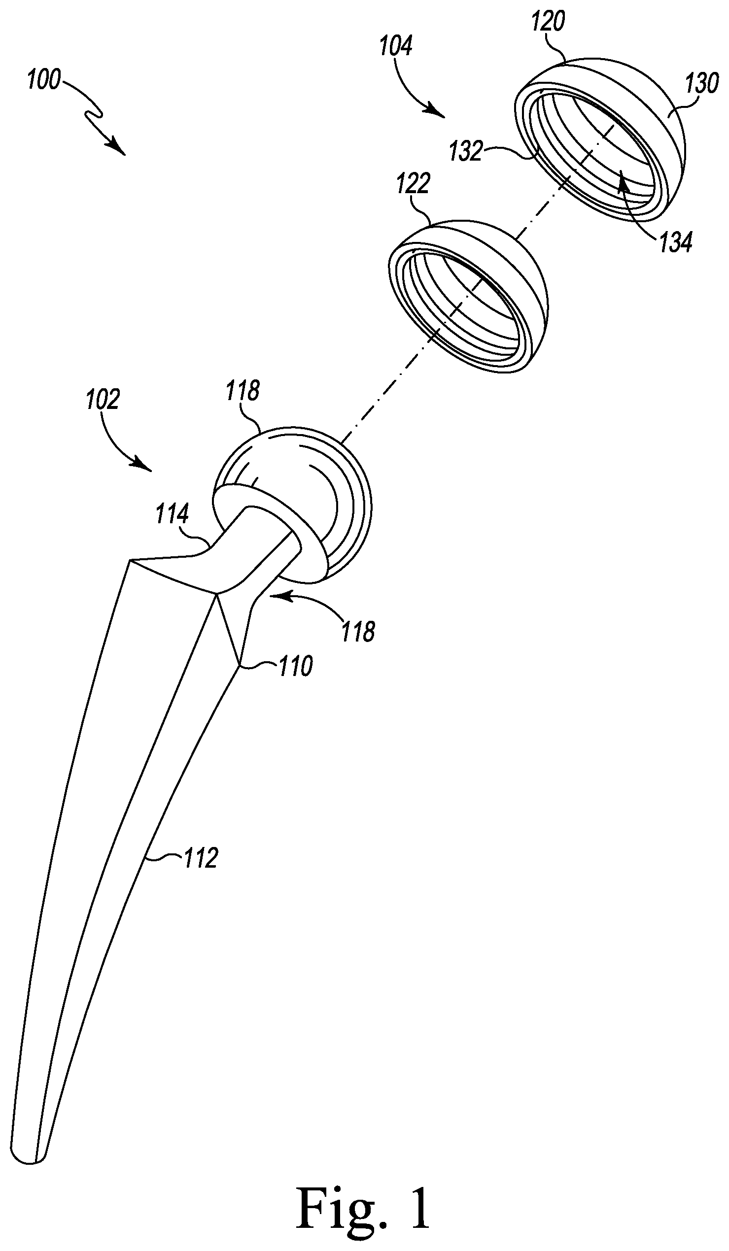 Patent US12611254 Figure 1 – Apparatus, system, and method for determining a position of a hip prosthesis in a bone of a patient