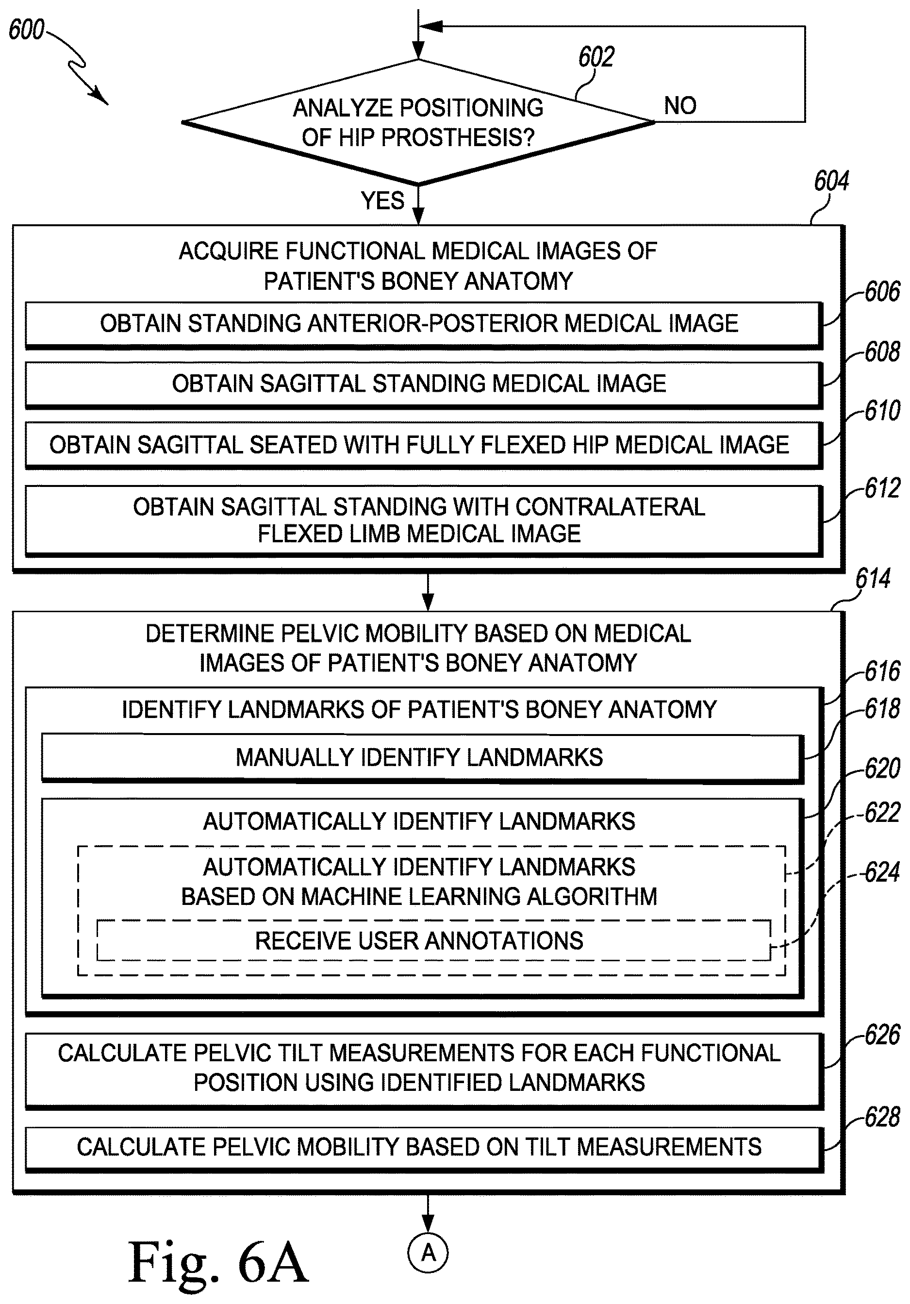 Patent US12611254 Figure 6 – Apparatus, system, and method for determining a position of a hip prosthesis in a bone of a patient