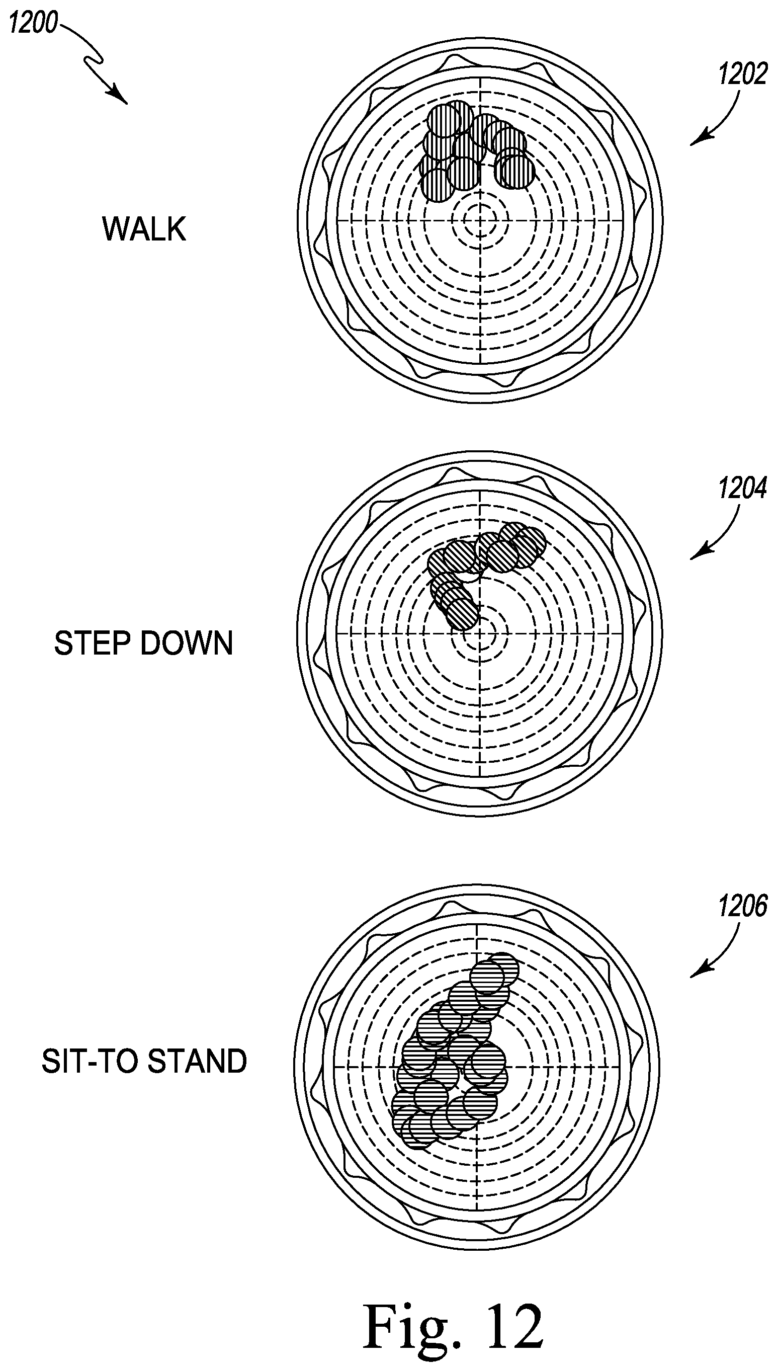 Patent US12611254 Figure 17 – Apparatus, system, and method for determining a position of a hip prosthesis in a bone of a patient