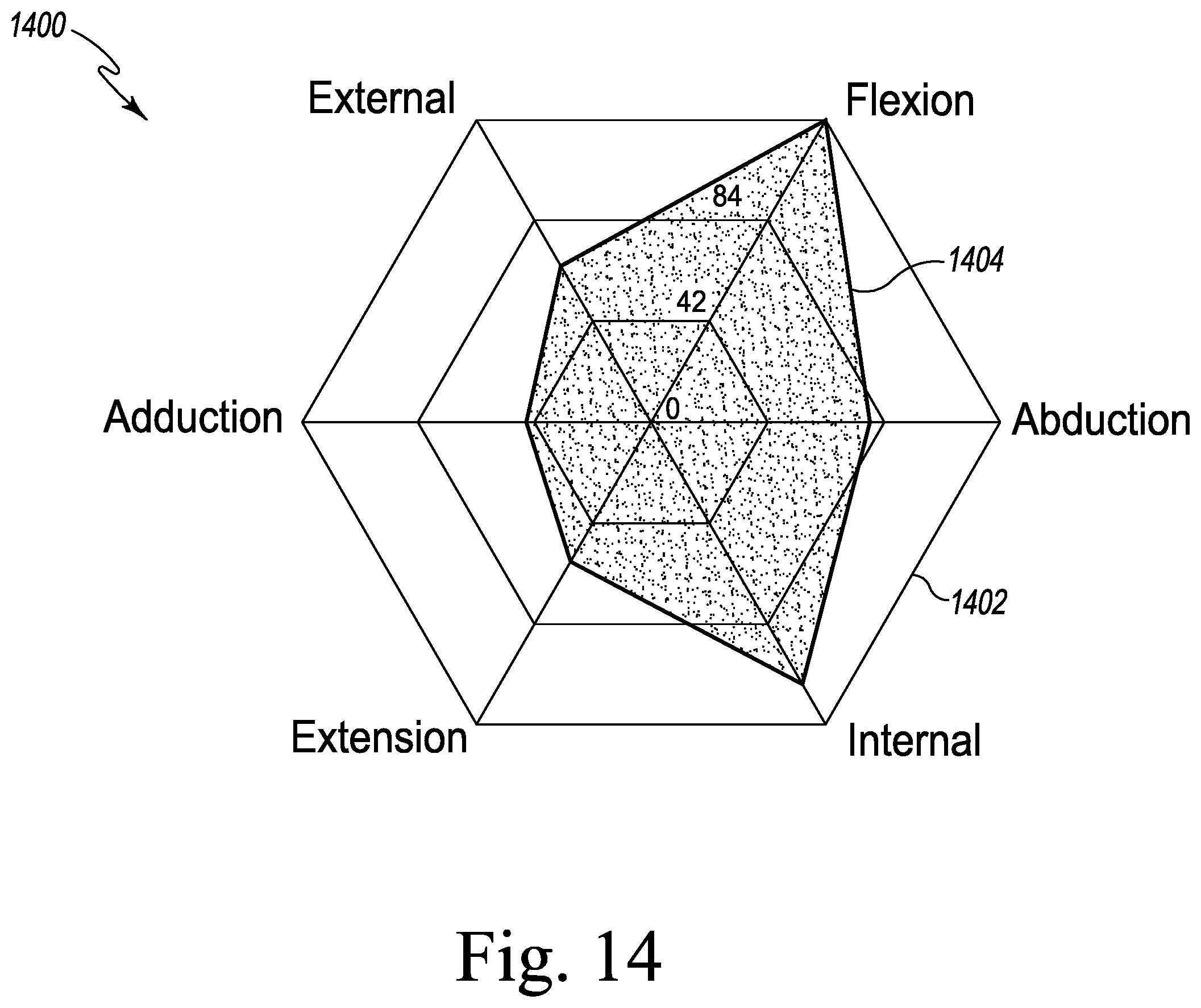 Patent US12611254 Figure 19 – Apparatus, system, and method for determining a position of a hip prosthesis in a bone of a patient