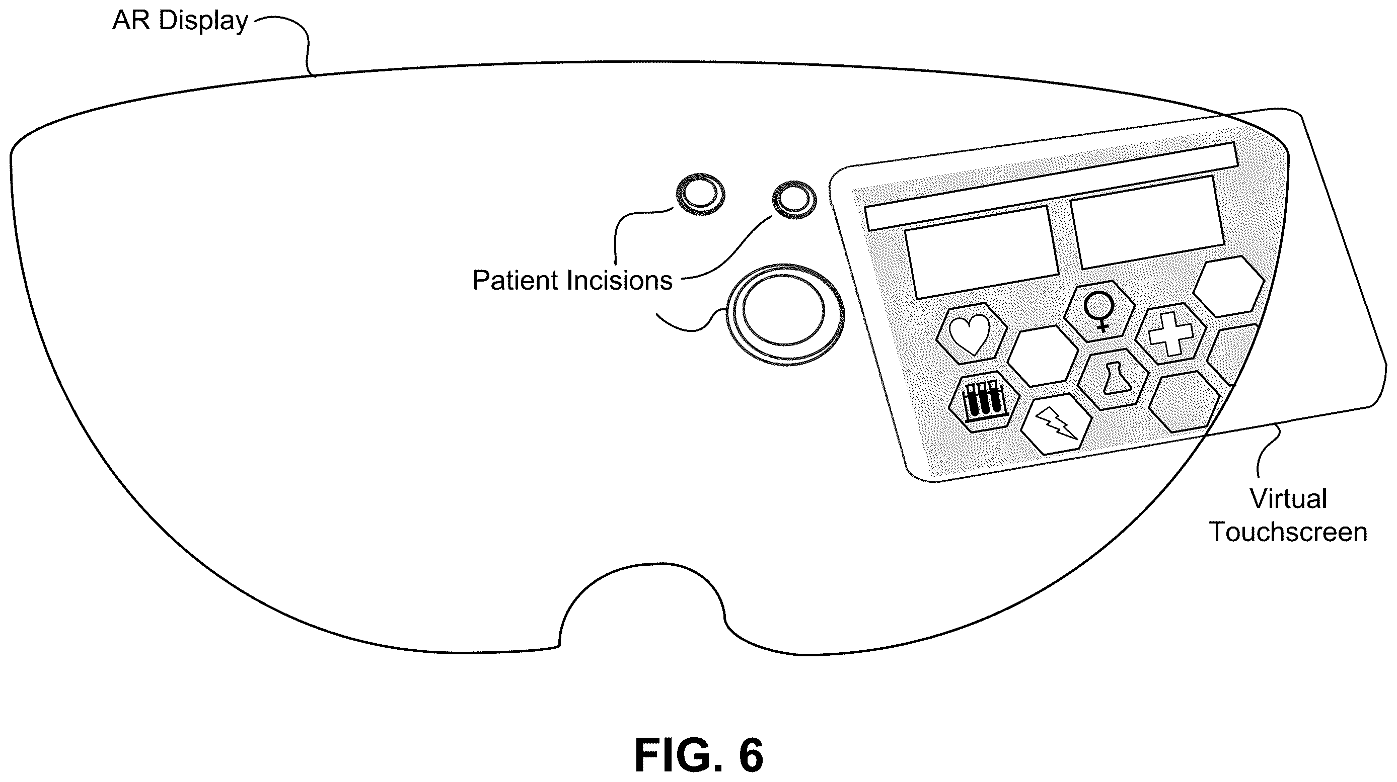 Patent US12611255 Figure 6 – Surgical systems, methods, and devices employing augmented reality (AR) for planning