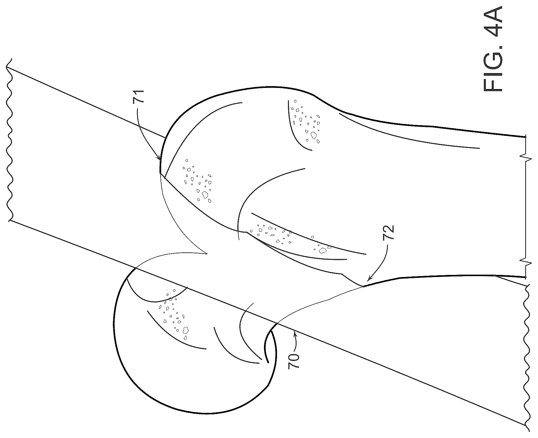 Patent US12611256 Figure 4 – Systems for superimposing a virtual display on a physical spine
