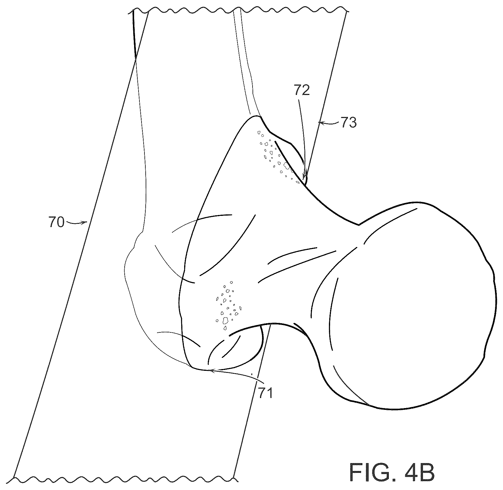 Patent US12611256 Figure 5 – Systems for superimposing a virtual display on a physical spine