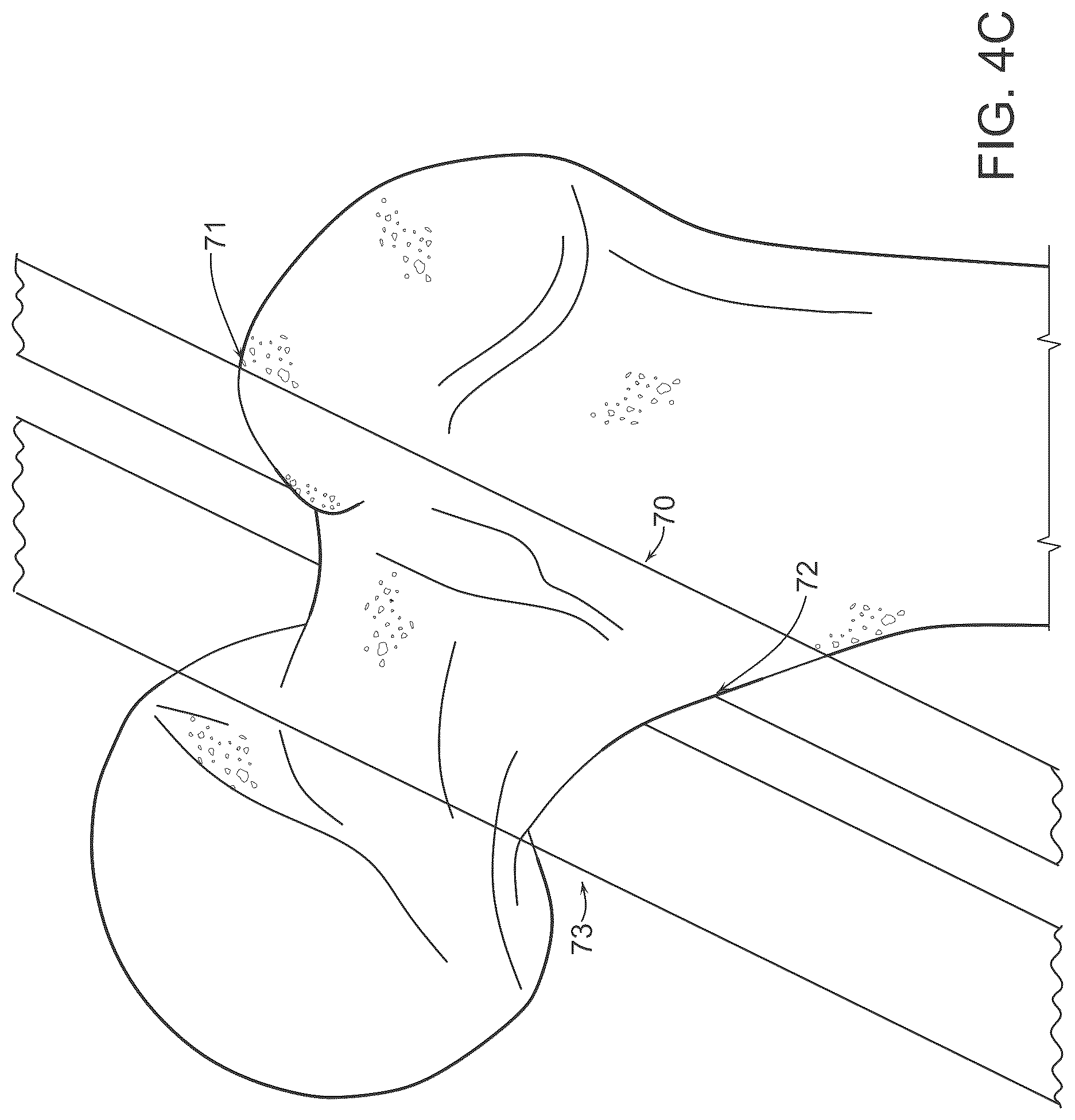 Patent US12611256 Figure 6 – Systems for superimposing a virtual display on a physical spine