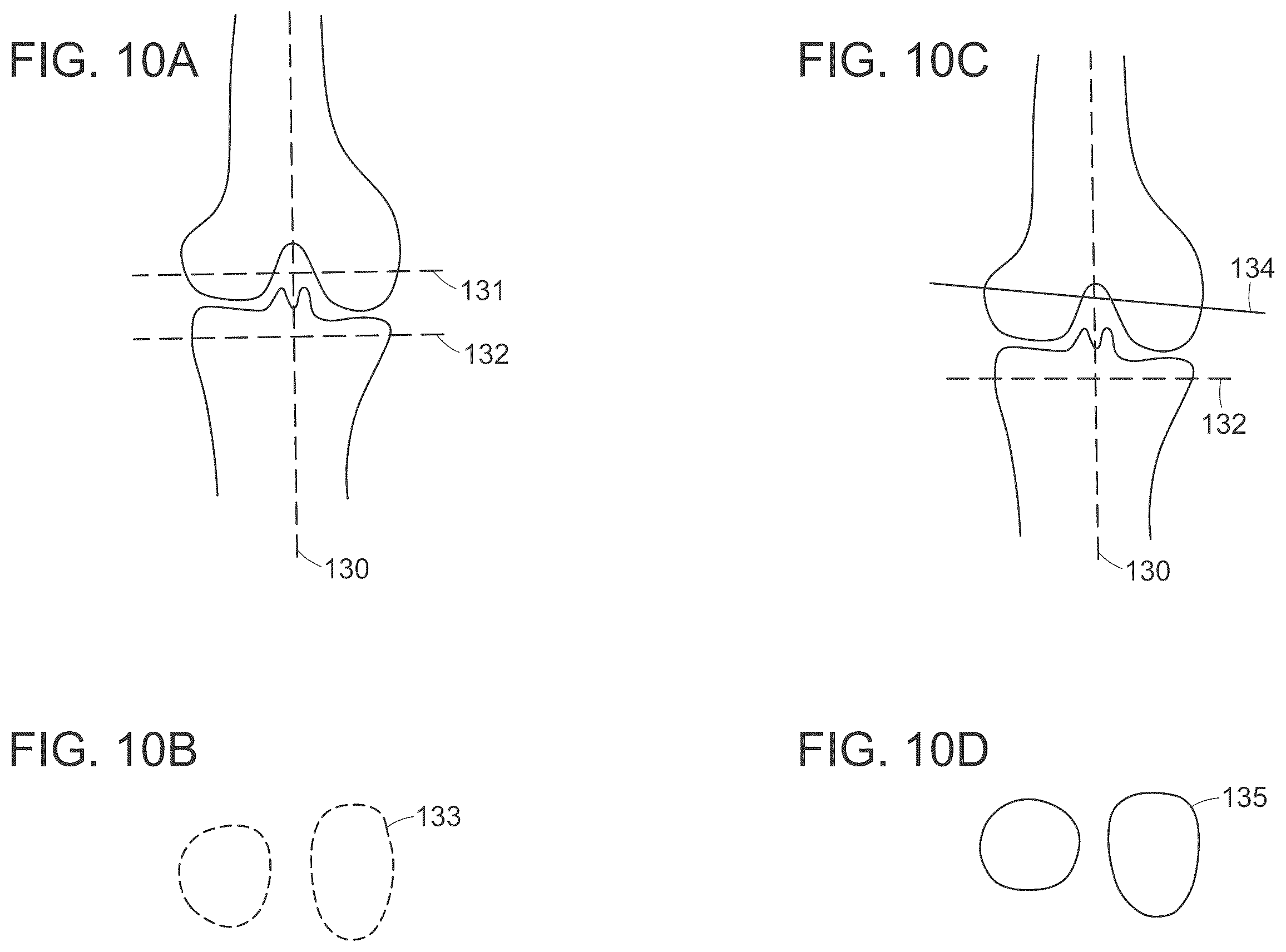 Patent US12611256 Figure 14 – Systems for superimposing a virtual display on a physical spine