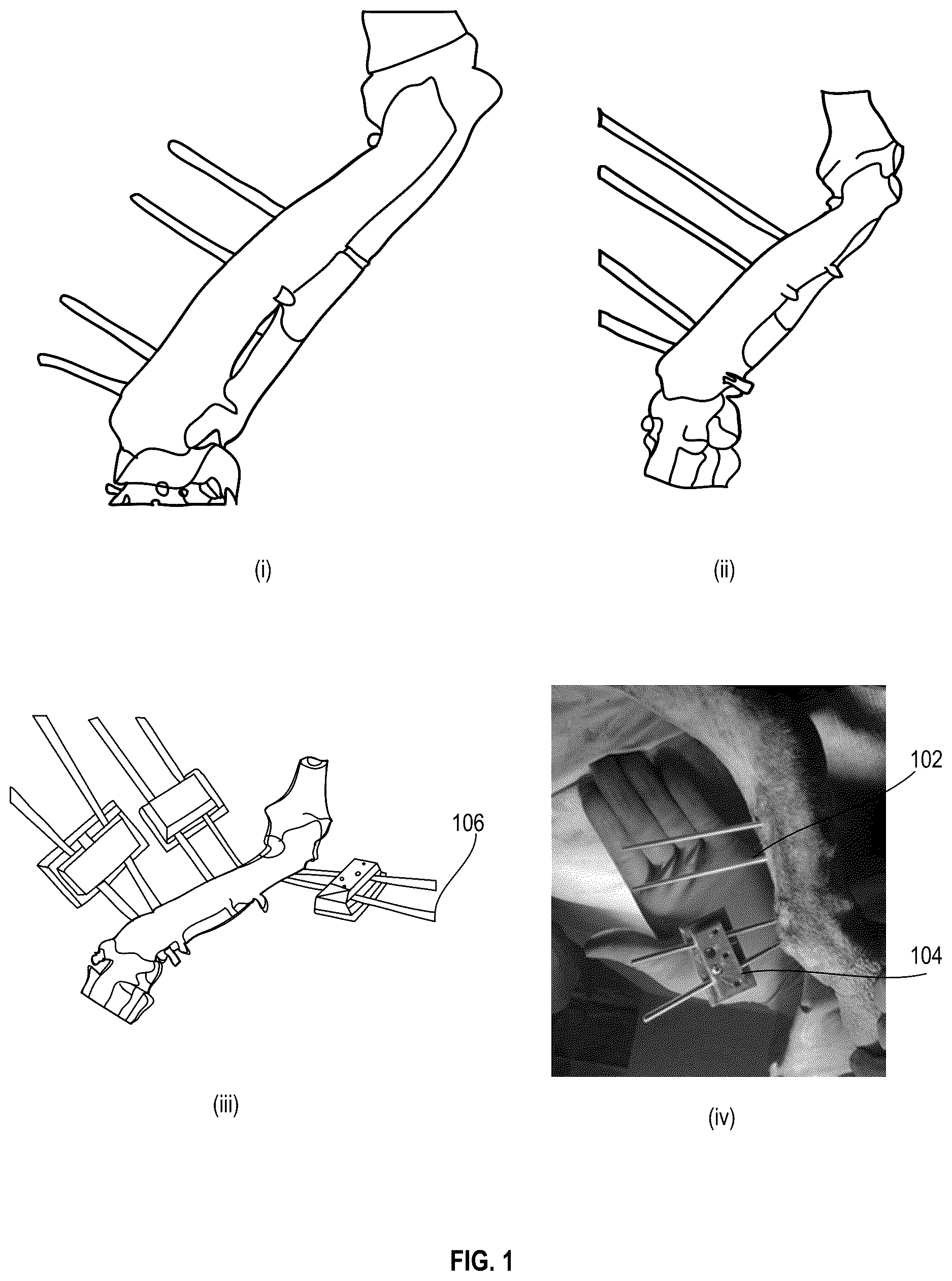 Patent US12611257 Figure 1 – Surgical kits for orthopedic surgery and associated surgical techniques