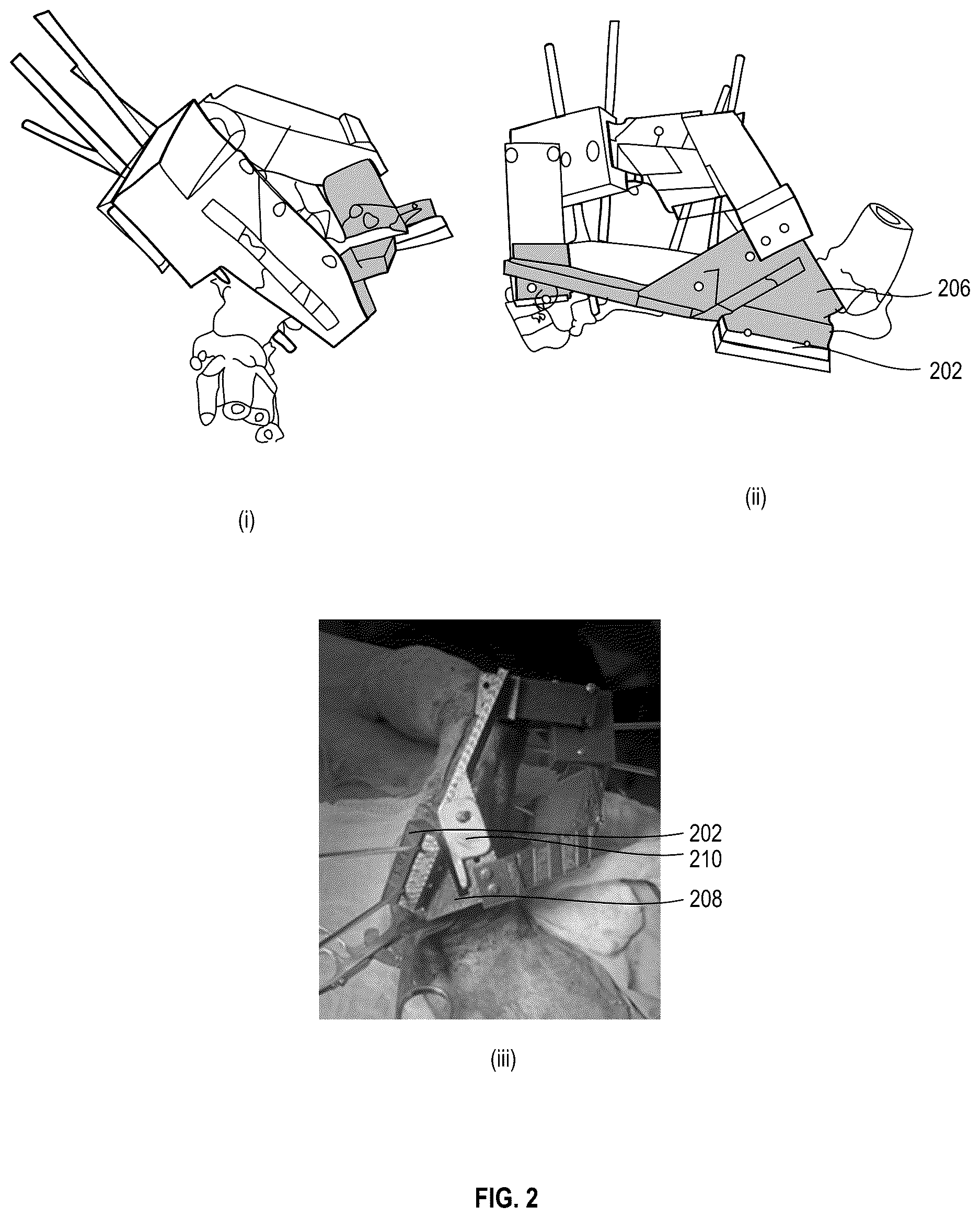 Patent US12611257 Figure 2 – Surgical kits for orthopedic surgery and associated surgical techniques