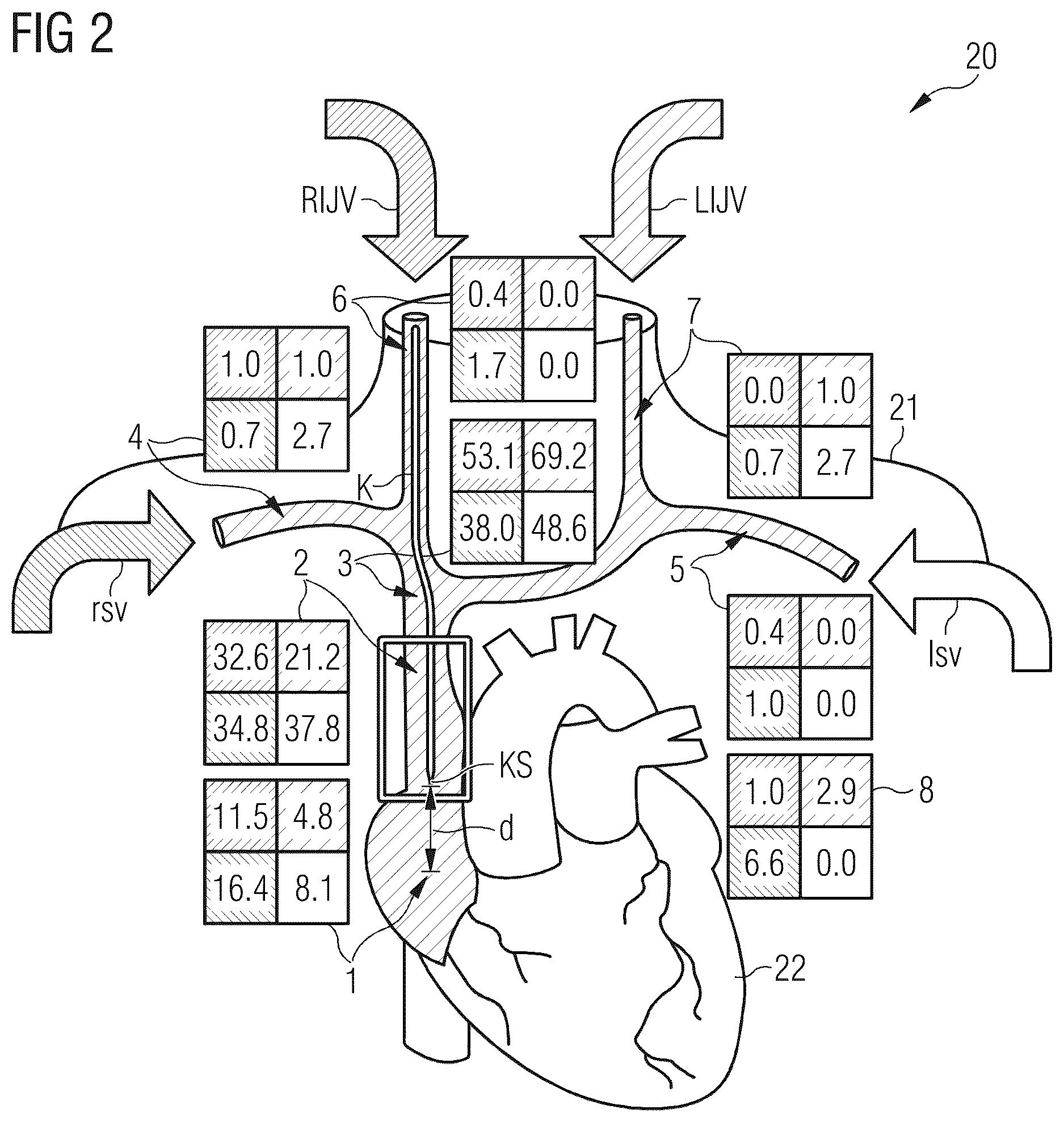 Patent US12611259 Figure 2 – Determining how well an object inserted into a patient's body is positioned