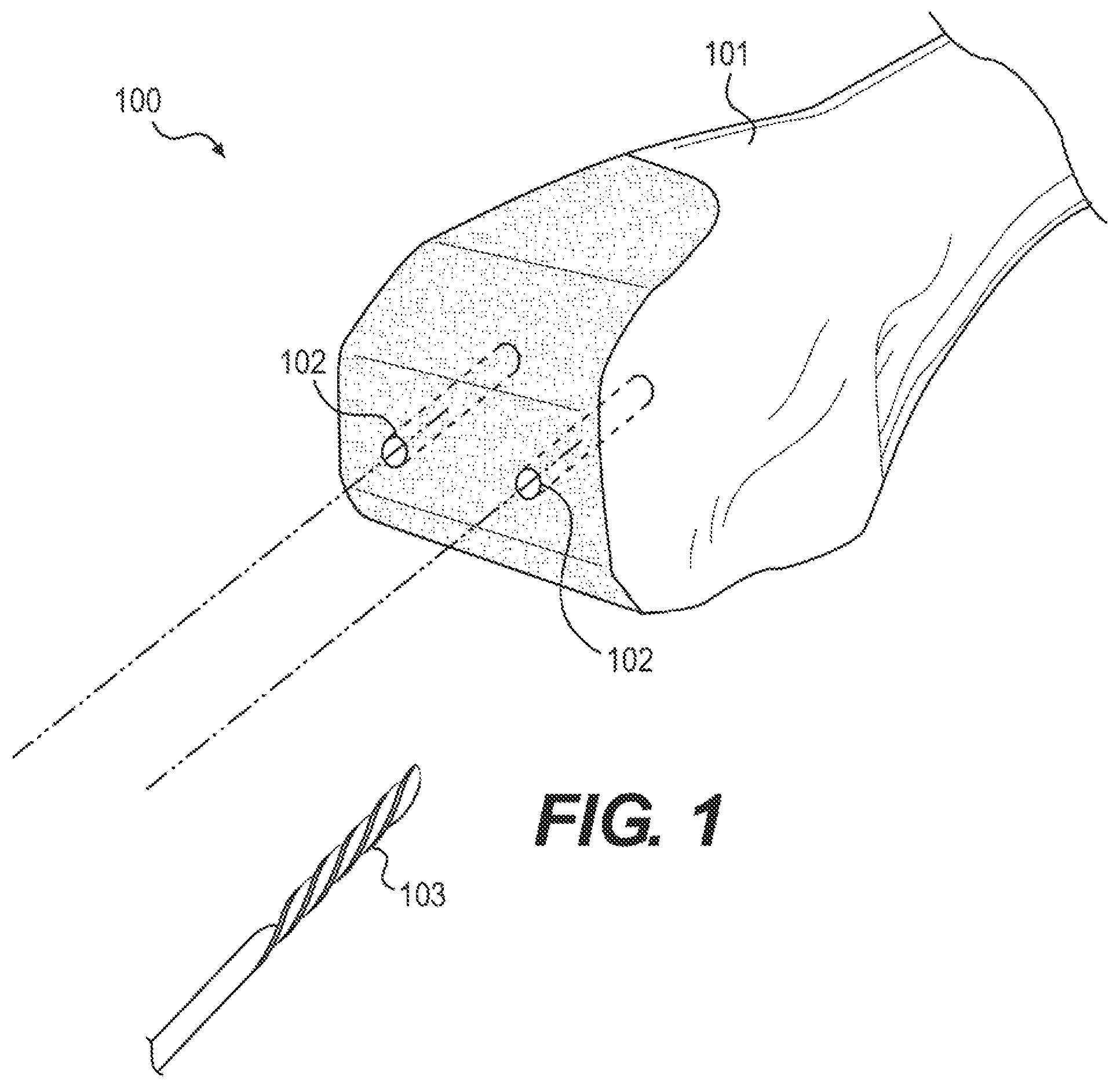 Patent US12611261 Figure 1 – Systems and methods for constrained surgical instrument alignment