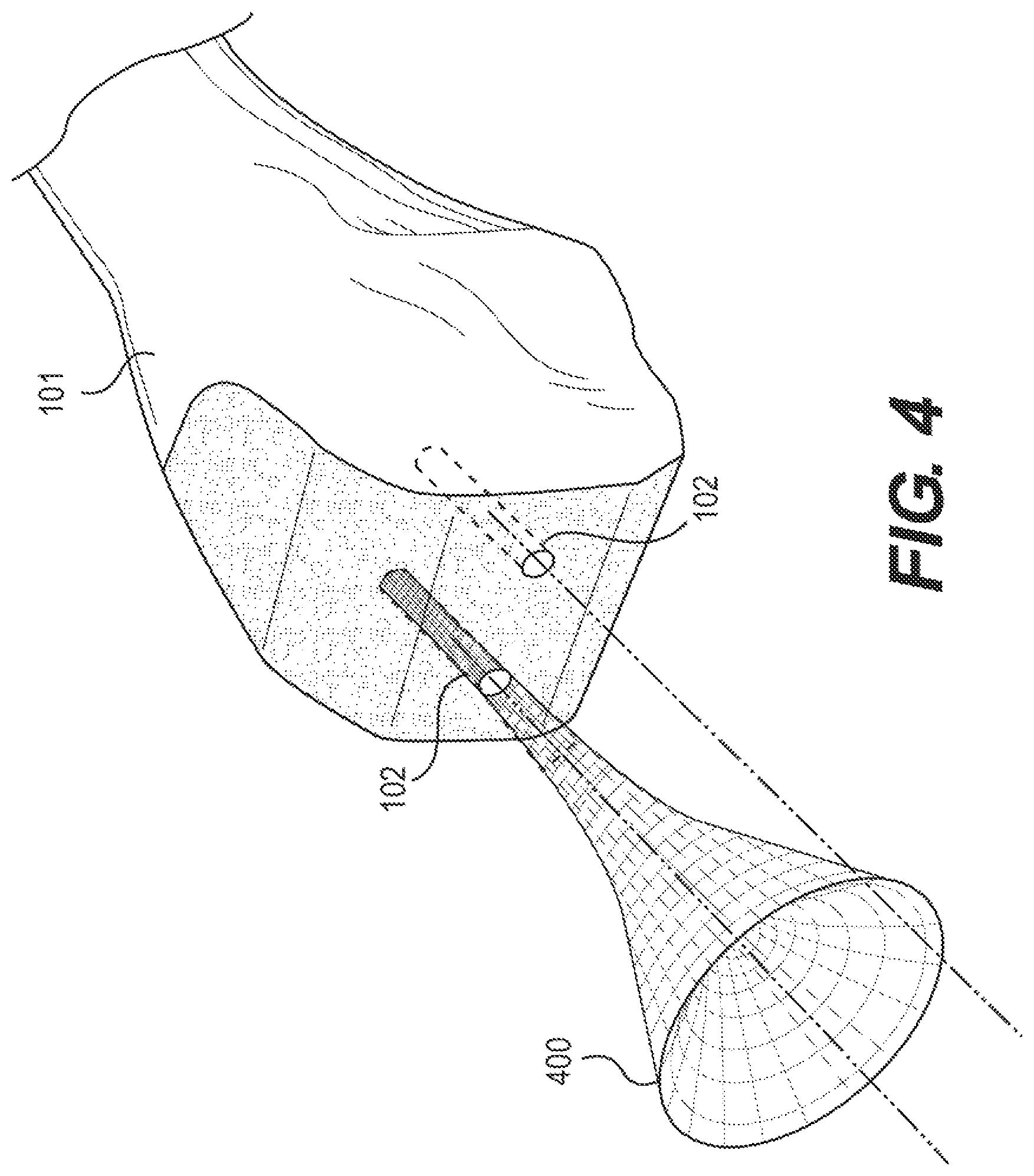 Patent US12611261 Figure 4 – Systems and methods for constrained surgical instrument alignment