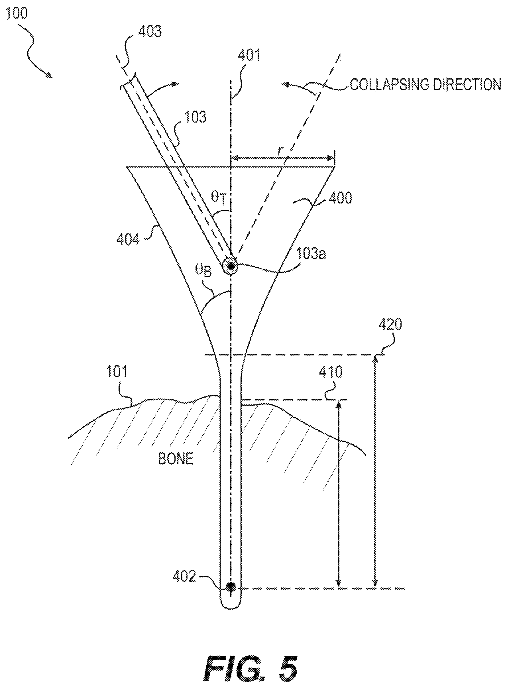 Patent US12611261 Figure 5 – Systems and methods for constrained surgical instrument alignment