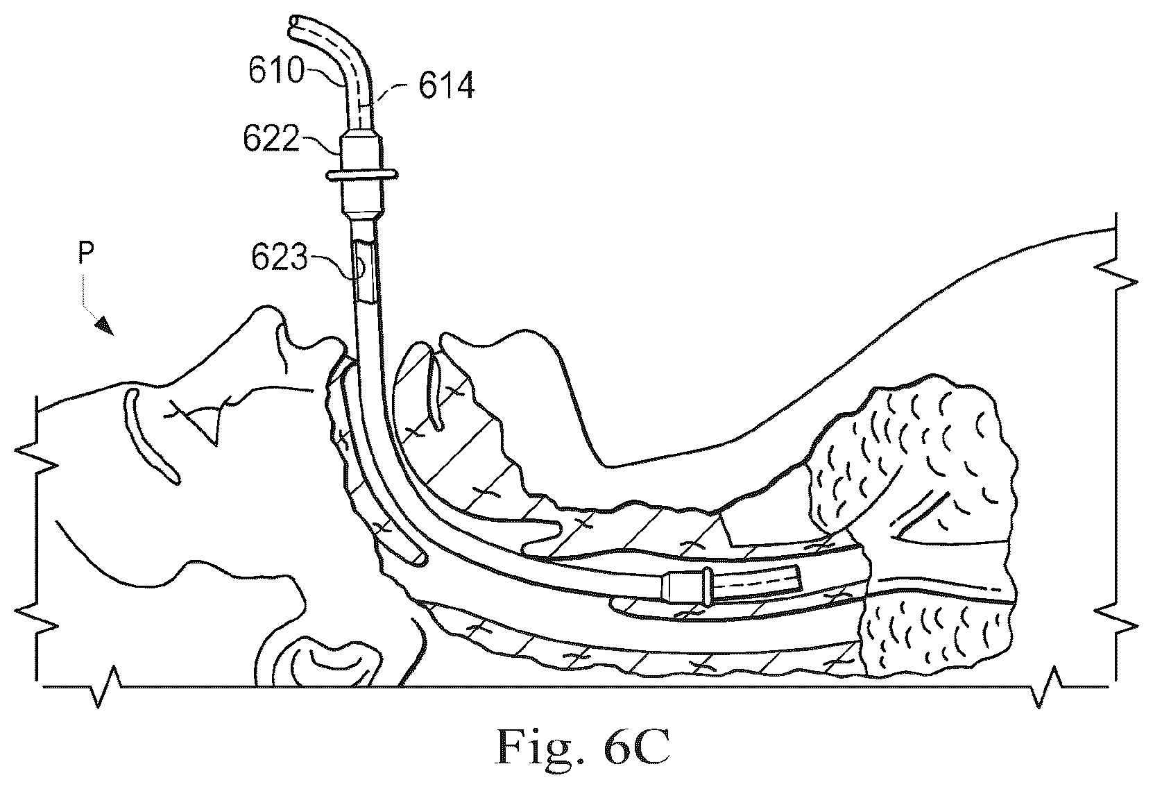 Patent US12611264 Figure 6 – Systems and methods of registration for image-guided procedures