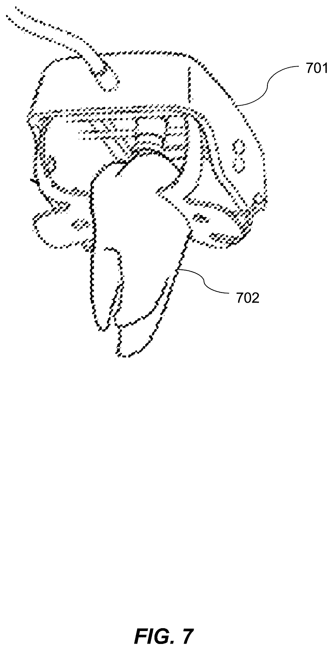 Patent US12611269 Figure 5 – Robotic dental system and method of preparing for a robotic dental procedure
