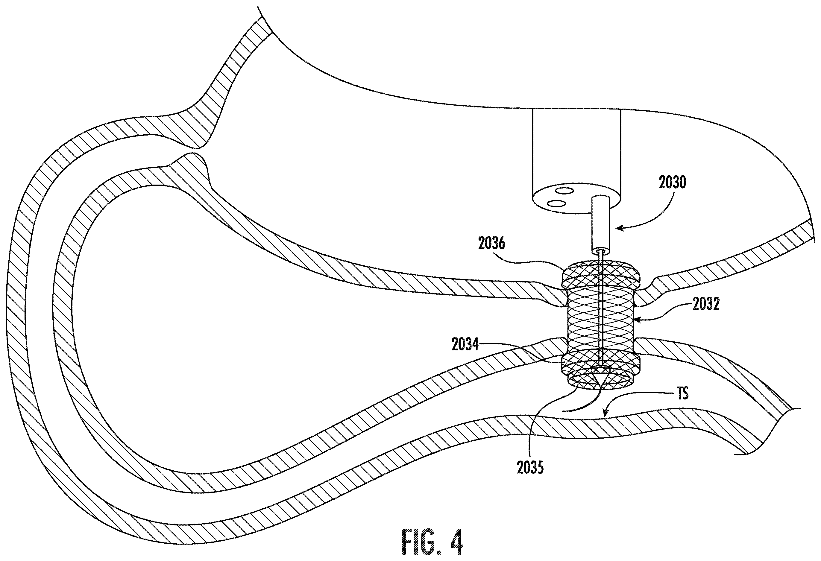 Patent US12611285 Figure 4 – Wireless devices, systems, and methods for endoscopic positioning